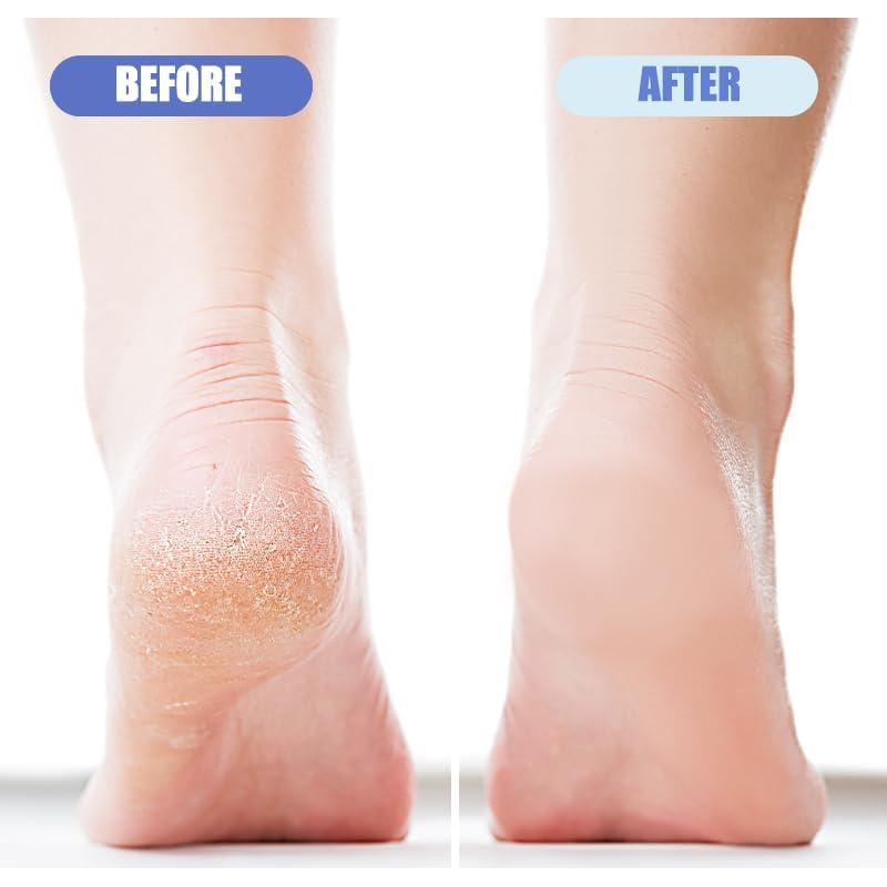 Paquete de 4 Pumices para Pies OHOO Exfoliador Doble Cara