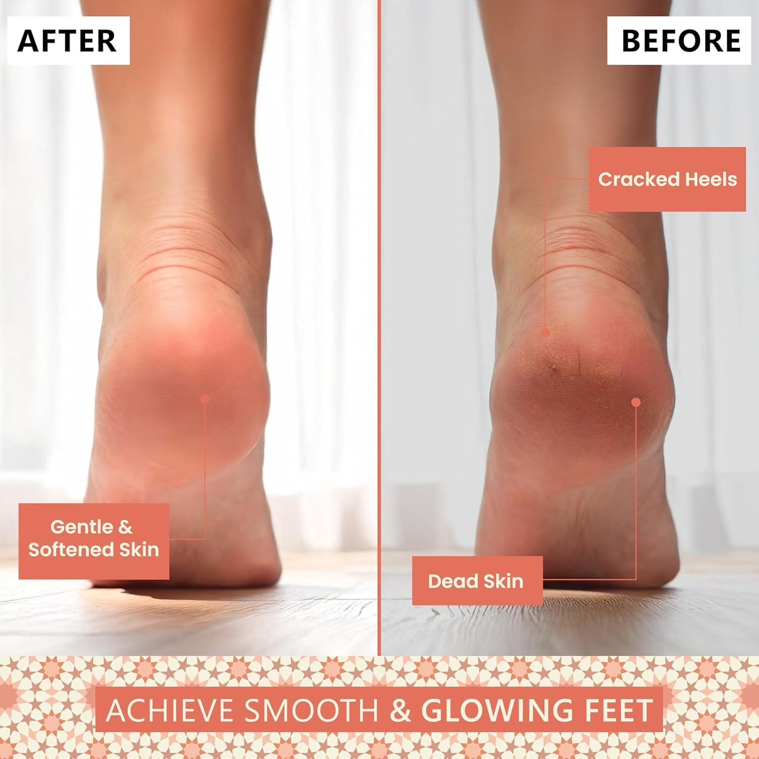 Piedra Pómez Natural Argaviva para Exfoliación de Pies 6.9cm