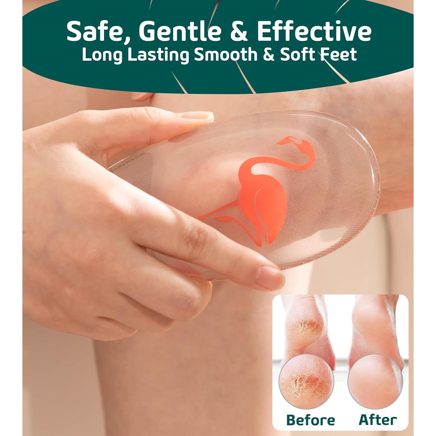 Lima de Vidrio Exfoliadora Sunivaca para Pies - Removedor de Callos