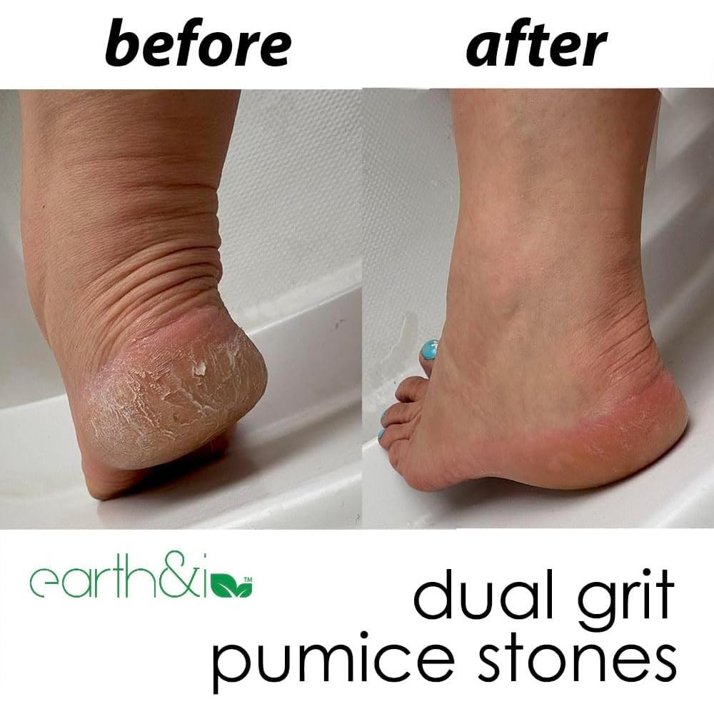Piedra Pómez Exfoliadora para Pies Tierra & Yo - 2 Unidades