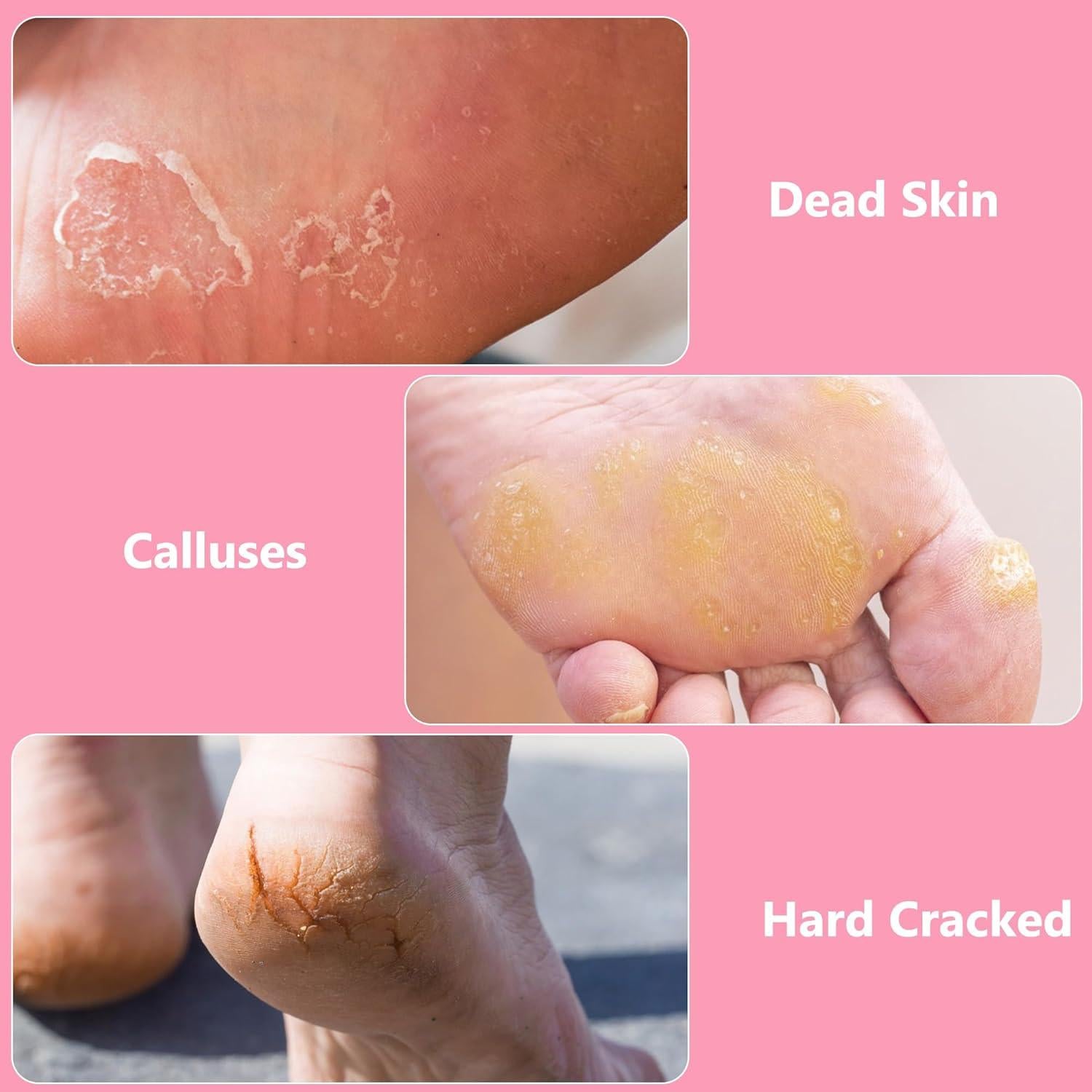 Lima de Pies Exfoliador OWIIZI Acero Inoxidable 28cm Rosa