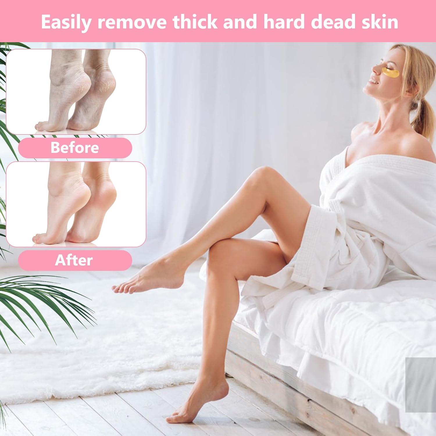 Lima de Pies Exfoliador OWIIZI Acero Inoxidable 28cm Rosa