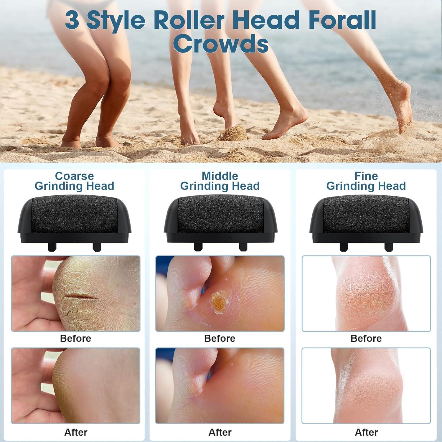 Removedor de Callos Eléctrico Hoxida con Luz y Soporte