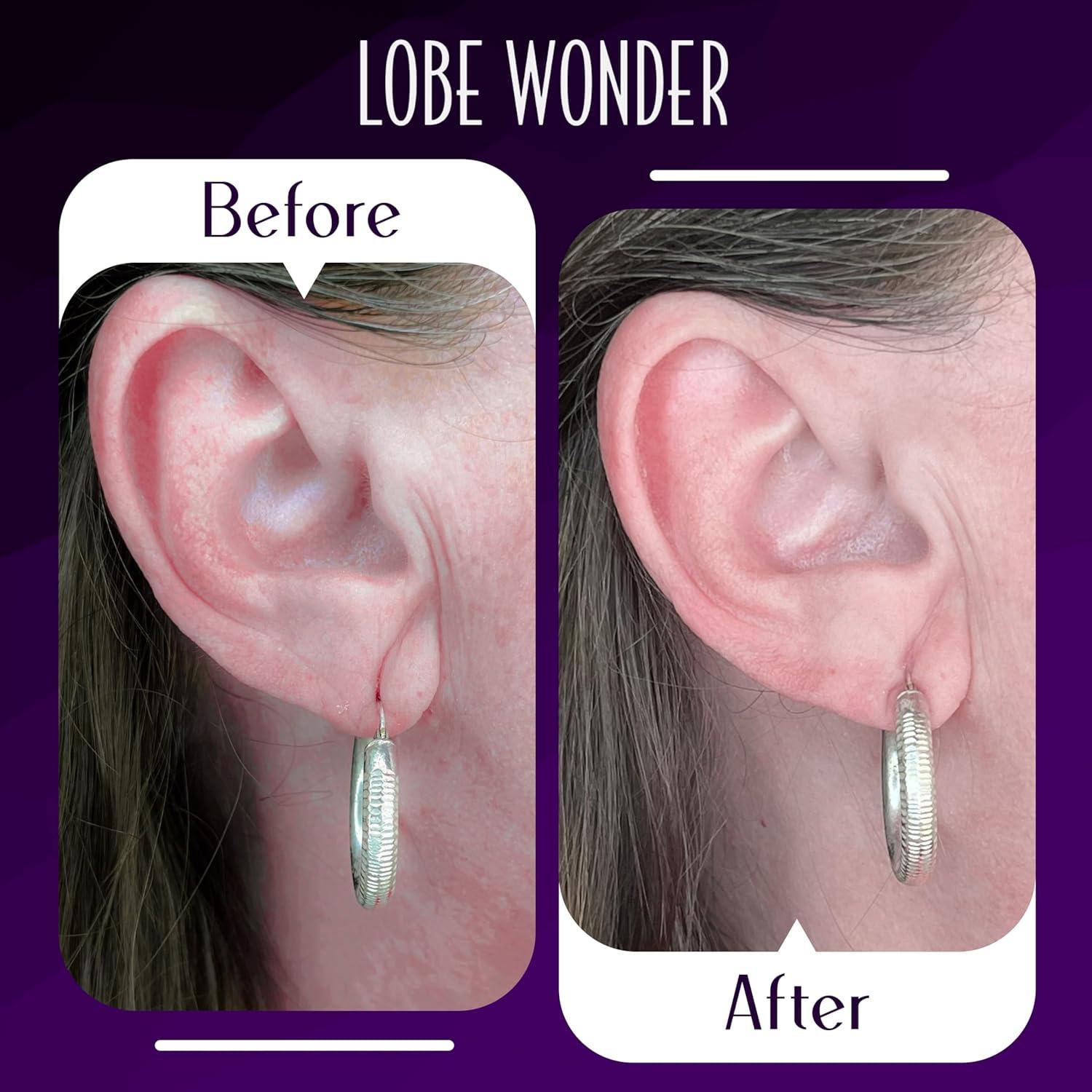 Parches Lobe Wonder para Soporte de Lóbulo de Oreja - 60 Unidades