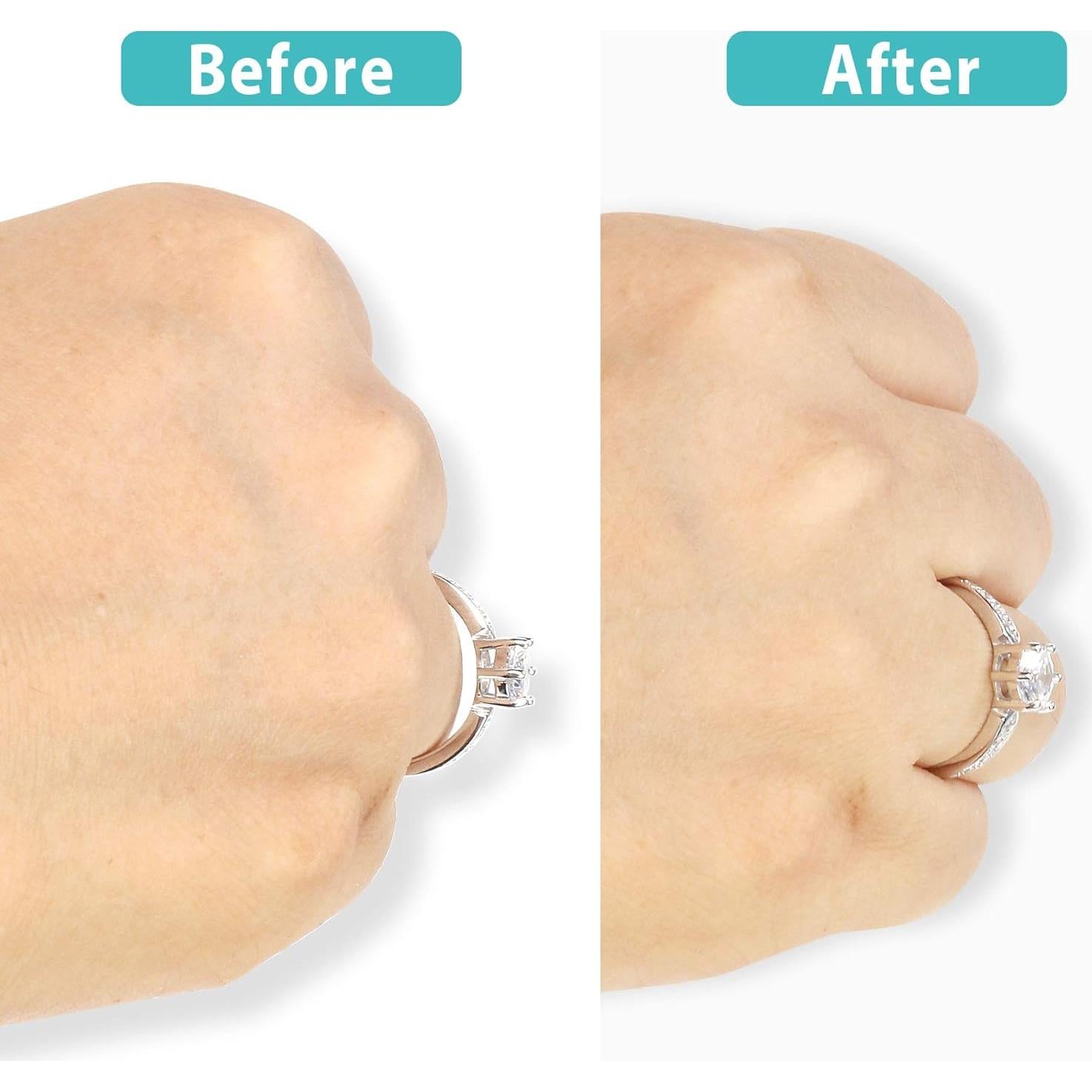 Ajustador de Anillo Invisible Feramox 8 Piezas para Anillos Sueltos