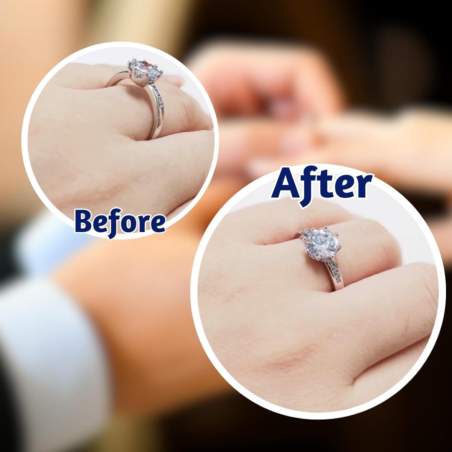 Ajustador de Talla de Anillos Calyders con Resina UV y Lámpara LED