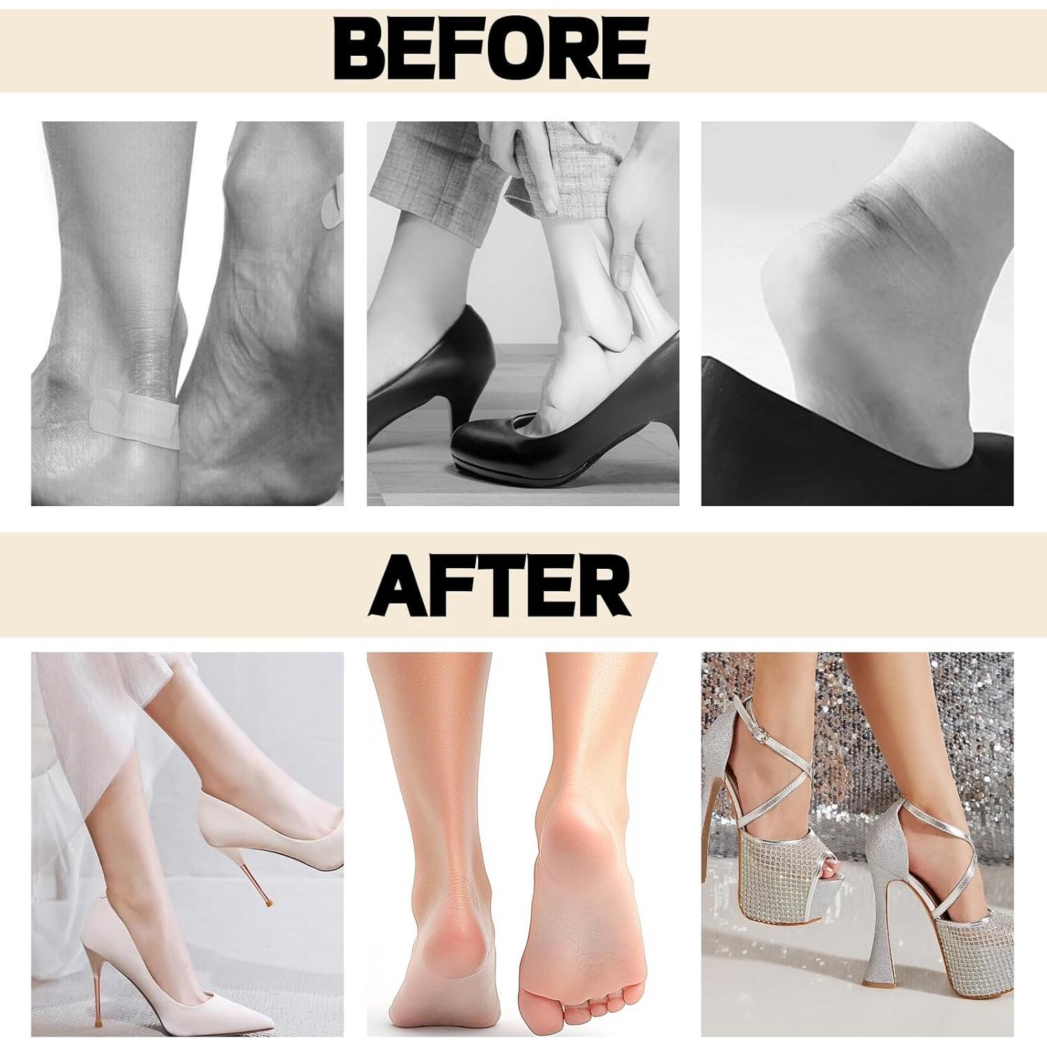 Almohadillas antideslizantes para talones Hganxiu - 6 pares