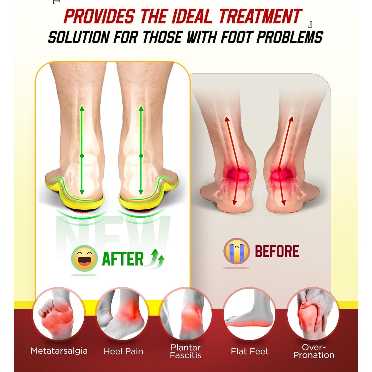 Plantillas Ortopédicas NEUPU para Fascitis Plantar XL Azul