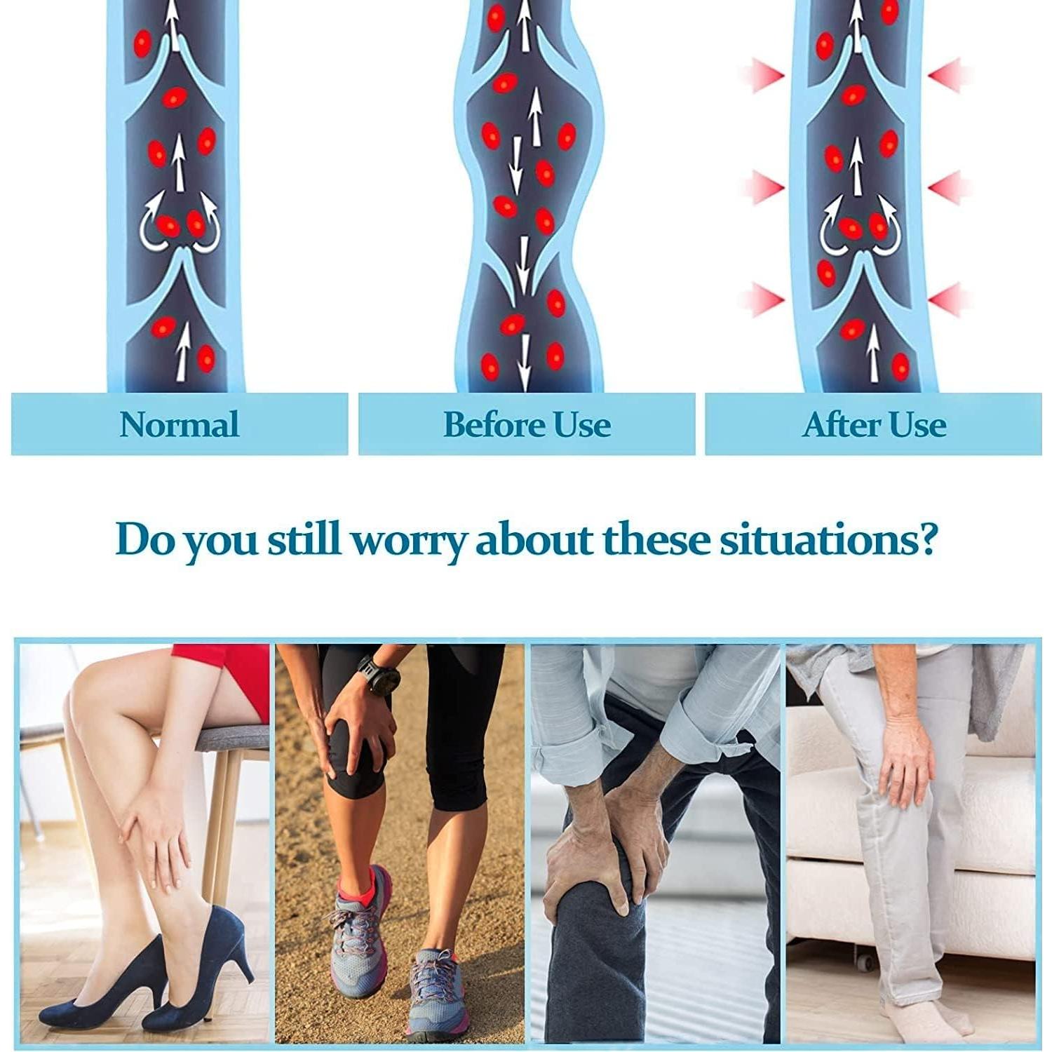 Calcetines de Compresión Ktinnead Unisex 20-30 mmHg Beige XX-Large