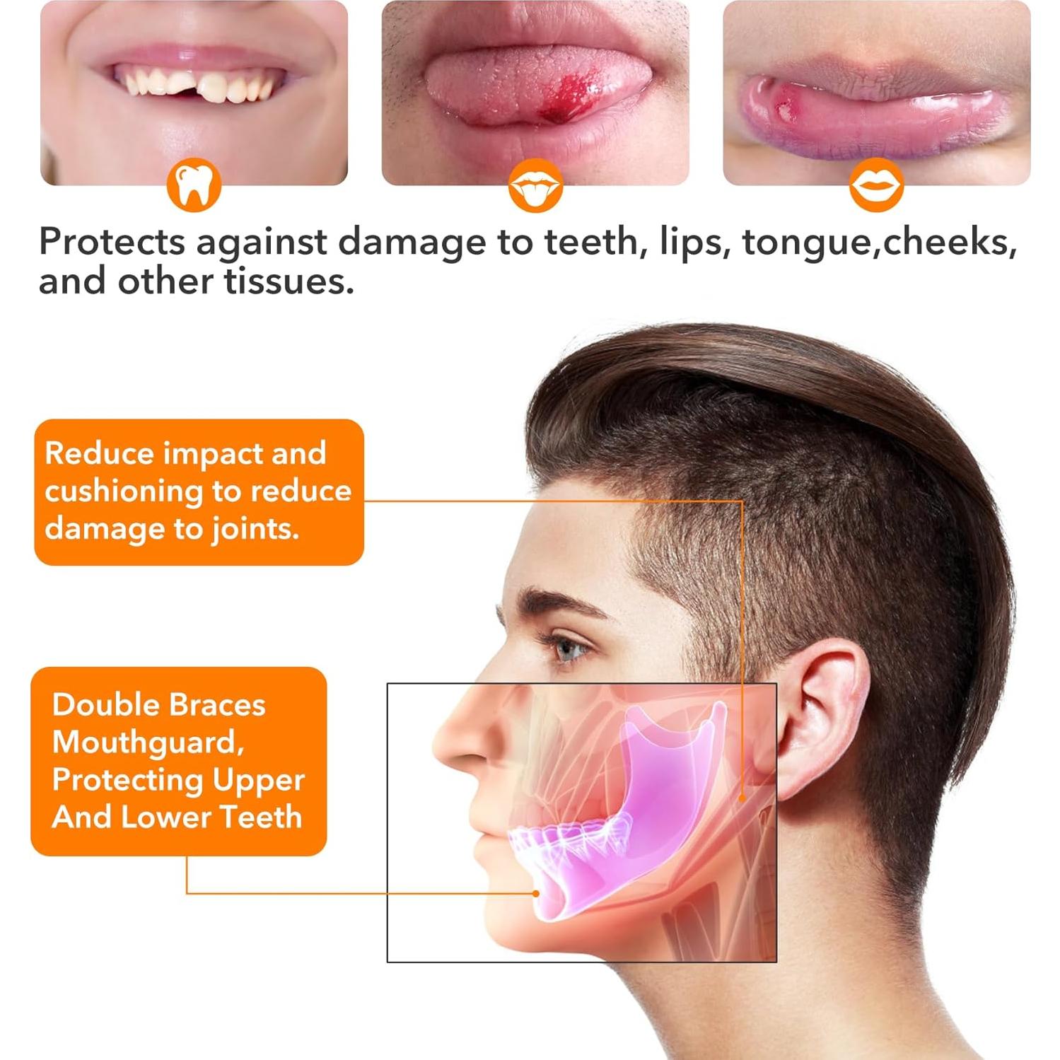 Protector Bucal Deportivo YIJU 2 Pcs Sin Hervir Naranja