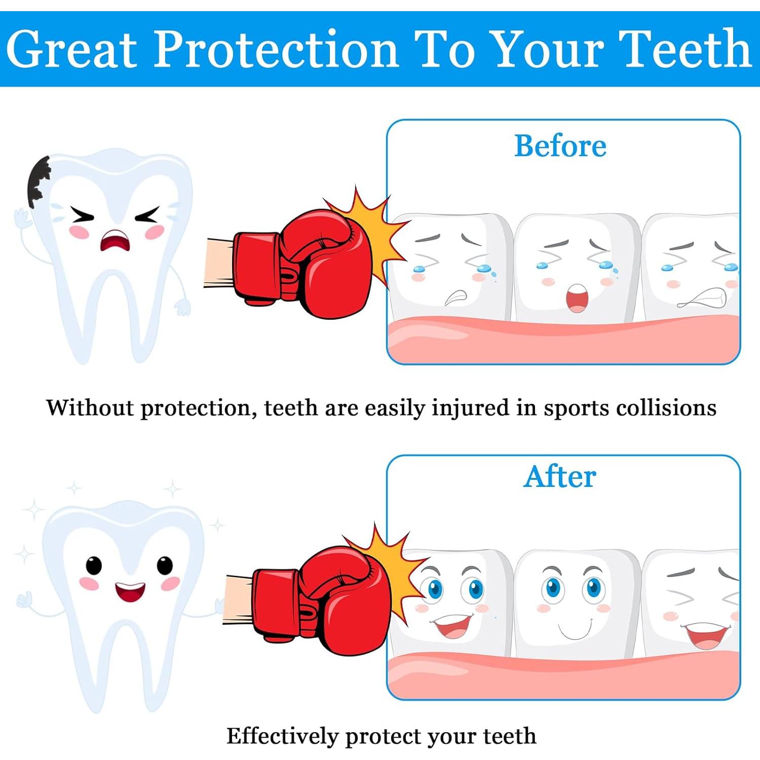 Paquete de 6 Protectores Bucales ProSuites para Deportes
