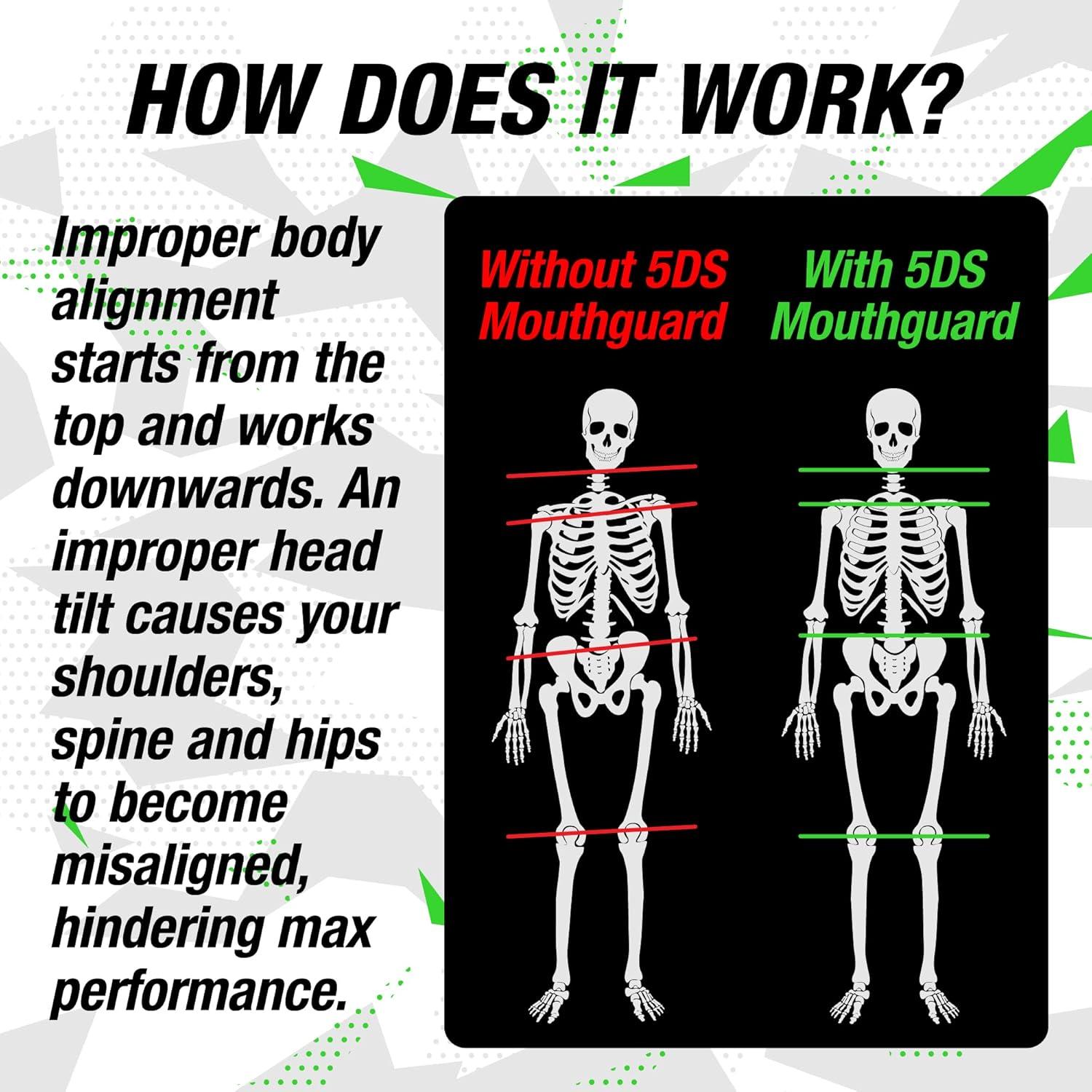 Protector Bucal Deportivo New Age 5DS Verde Lima para Fútbol y Rugby