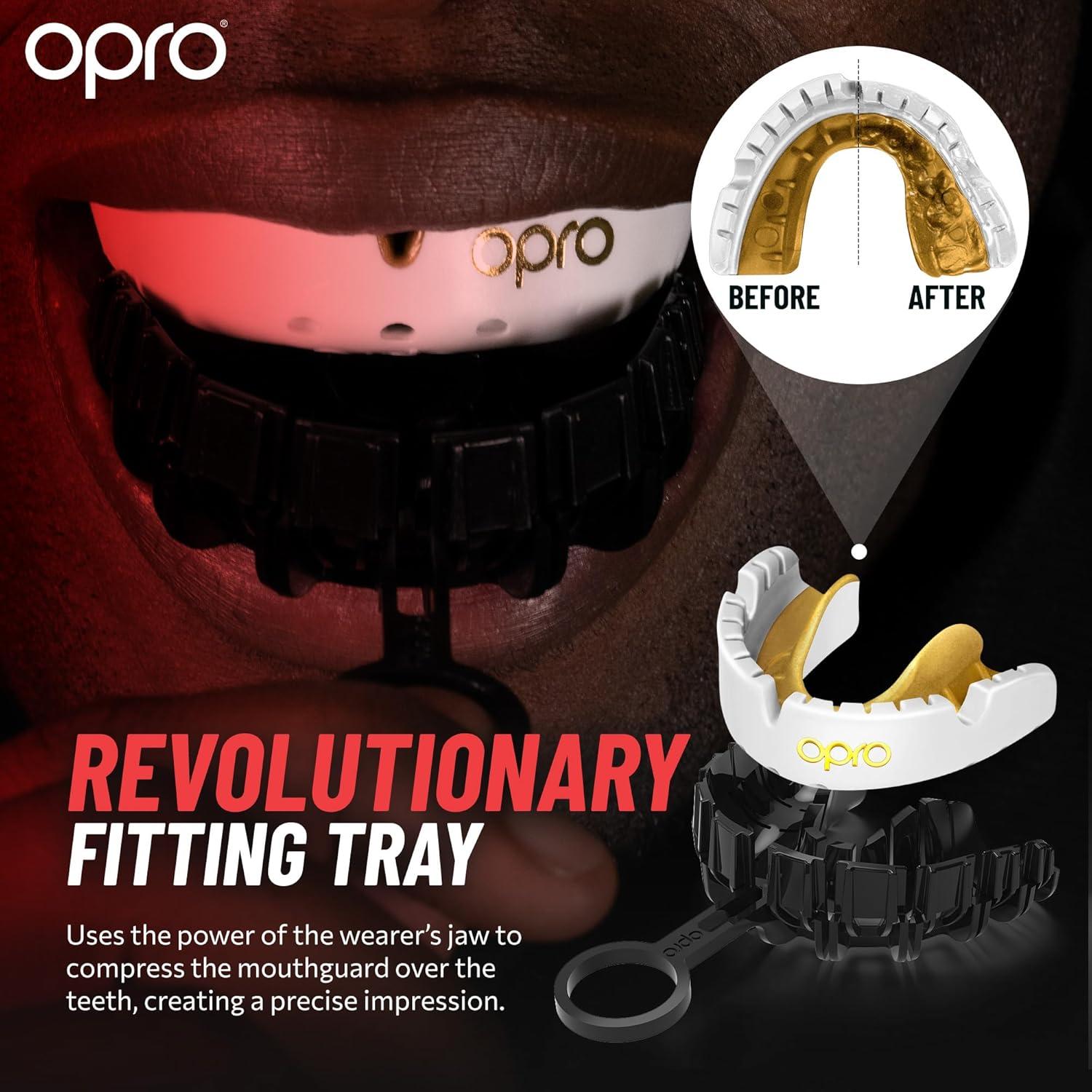 Protector Bucal OPRO Gold para Brackets - Negro, Ajustable