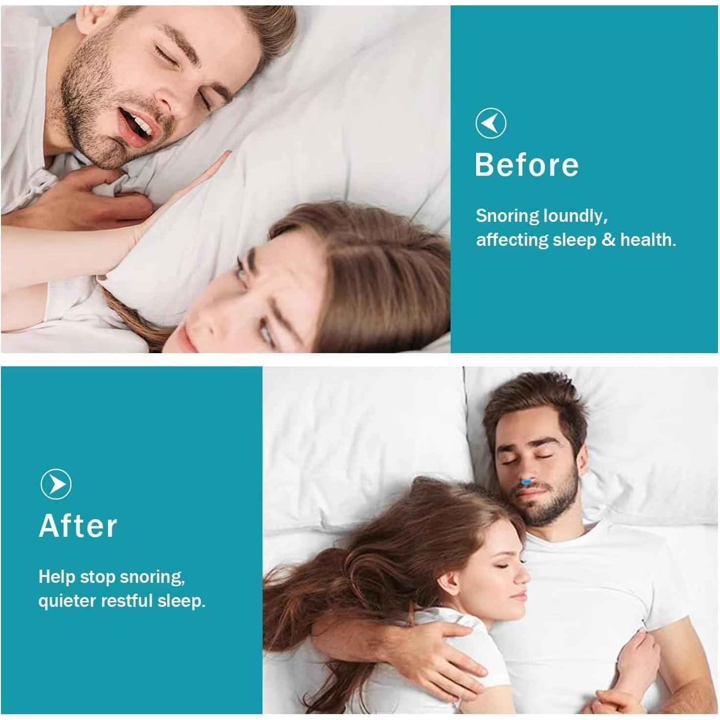 MS Esther Snore Stopper 6Pcs，Anti Snoring Devices, Silicone Magnetic Anti Snoring Nose Clip, Effective to Stop Snoring, Quieter Restful Sleep