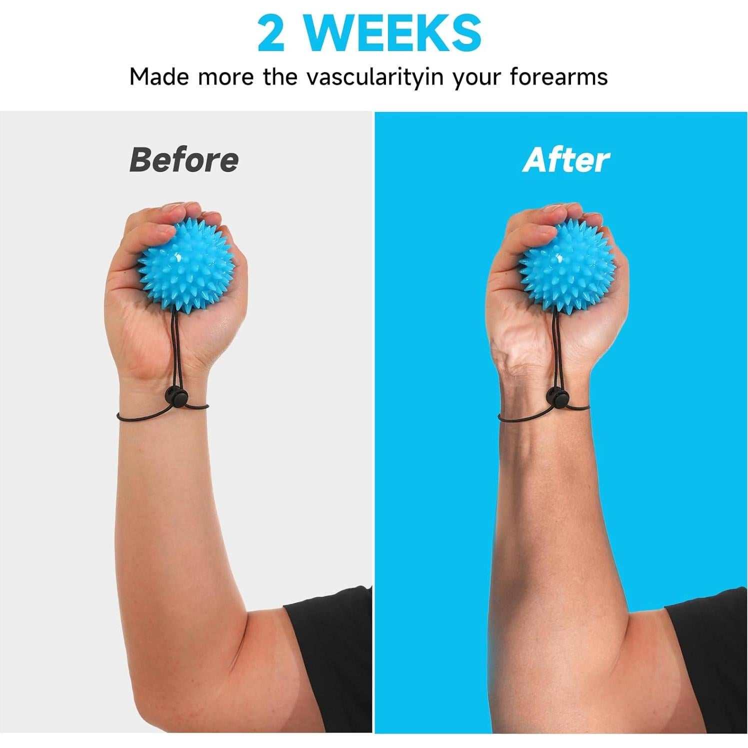 Pelotas de Compresión Fanwer para Terapia de Mano - 2 Piezas