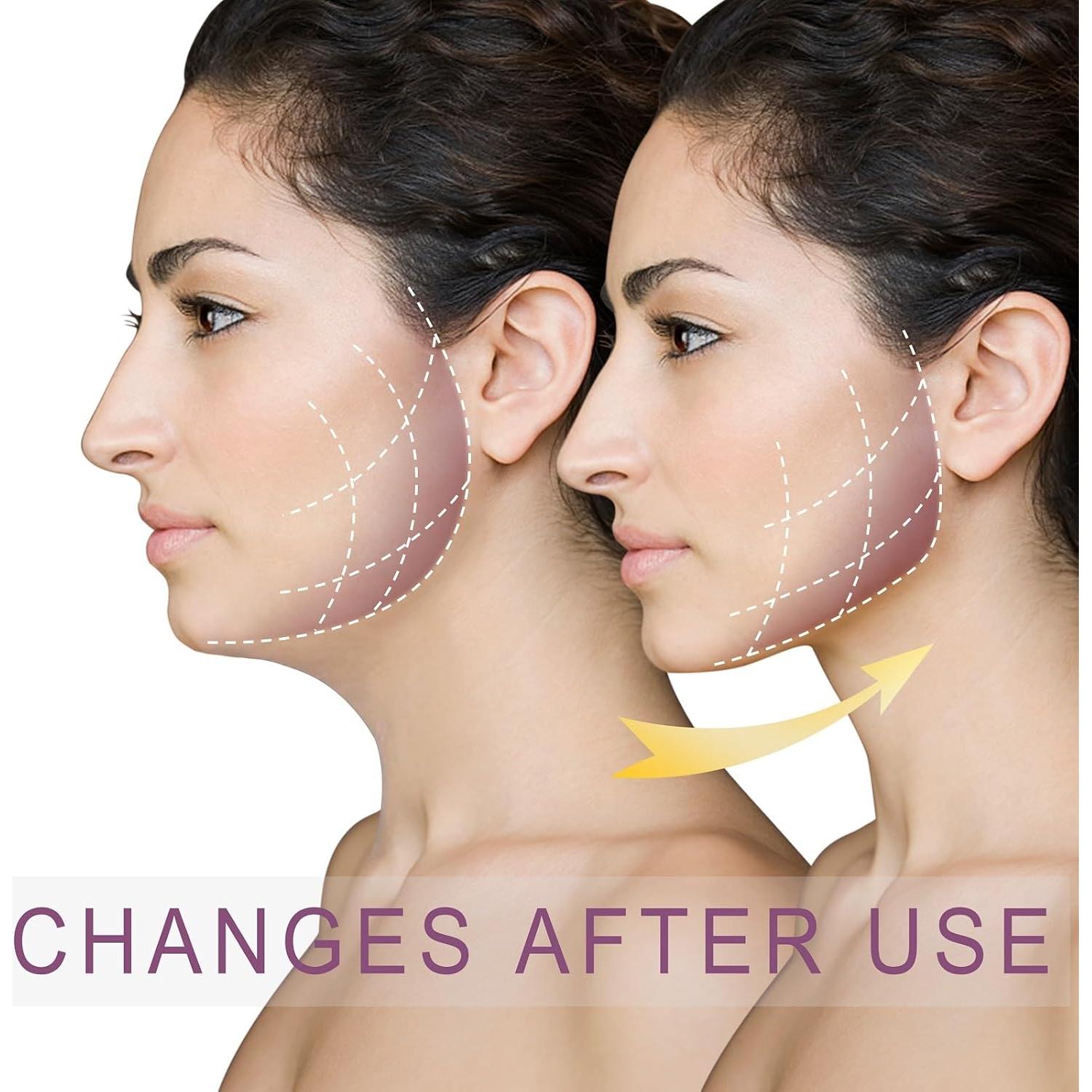 Máscara de levantamiento V EDCBMB para dormir - Rosa - Mediana