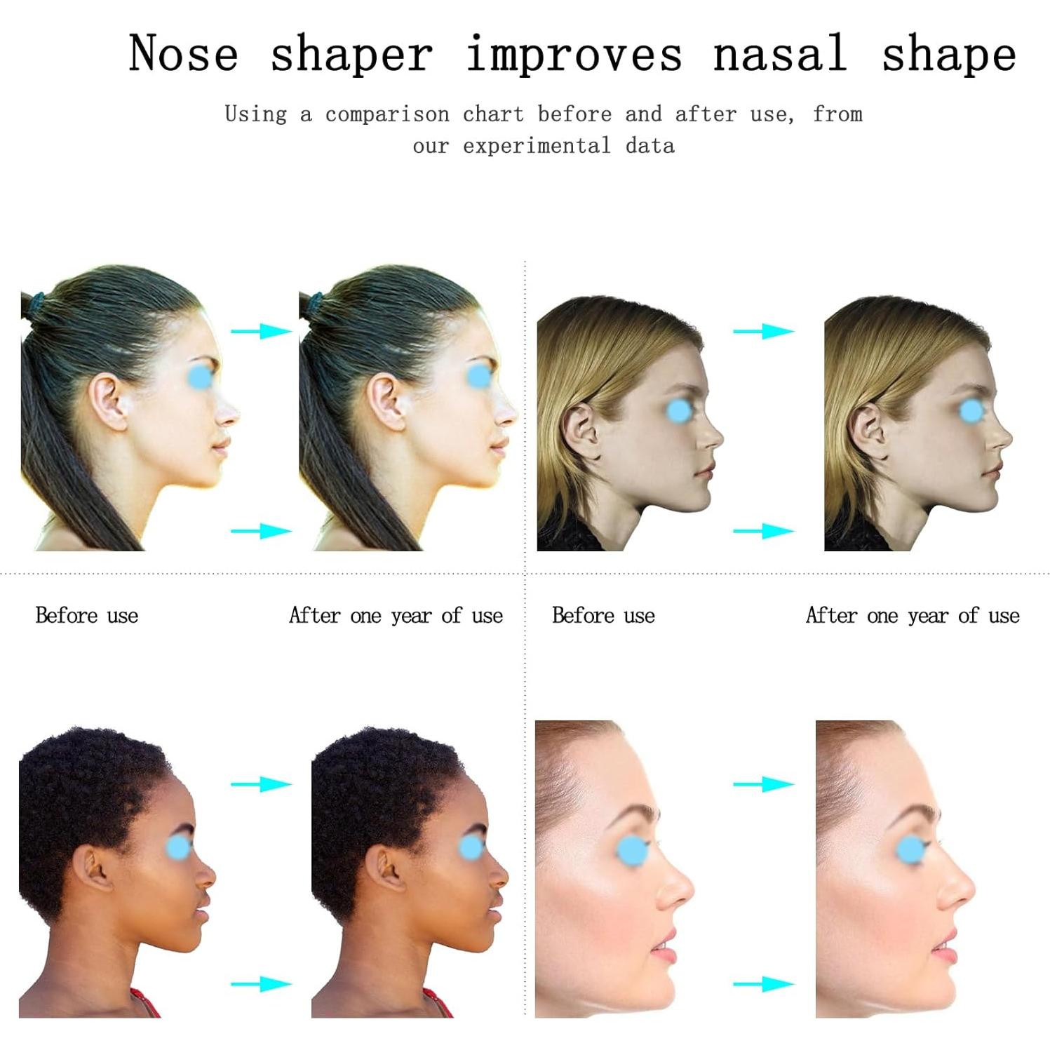 Jieri Nose Shaper Lifter Clip - Reshape & Straighten Wide Noses for Men & Women