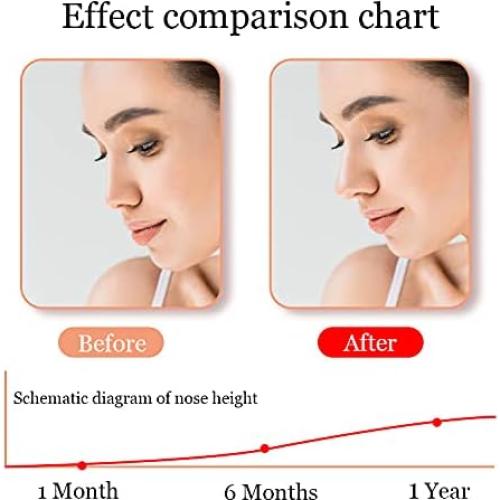 Jieri Nose Shaper Lifter Clip - Reshape & Straighten Wide Noses for Men & Women