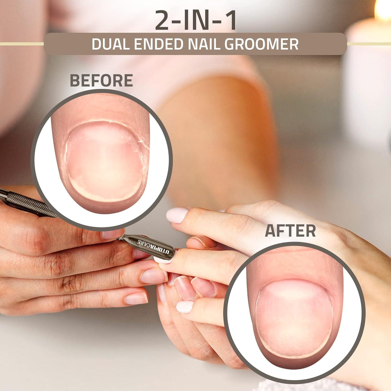 Empujador de Cutículas Utopia Care Acero Inoxidable 14 cm