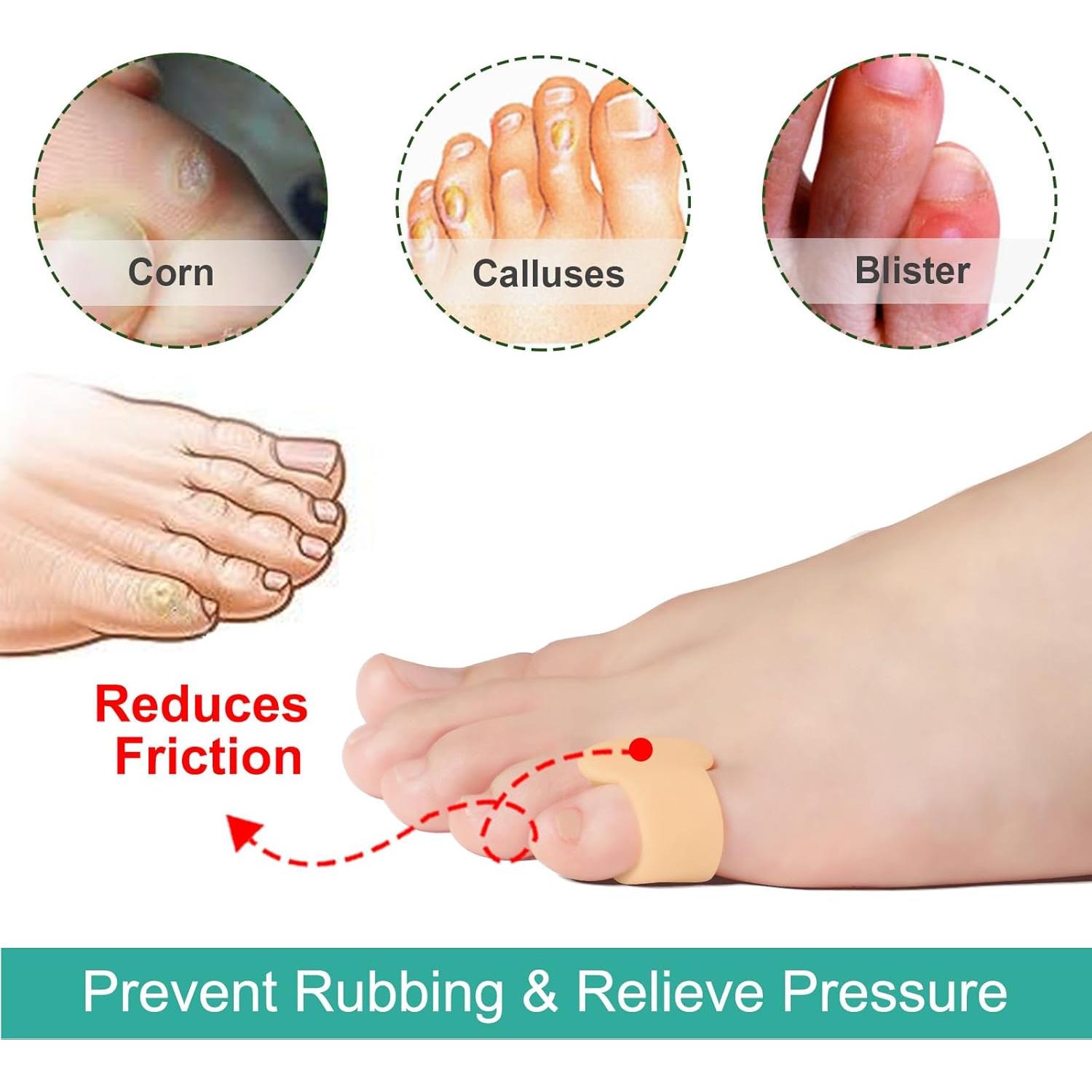 Separador de Dedos Welnove - 8 Cojines para Dedo Meñique Beige