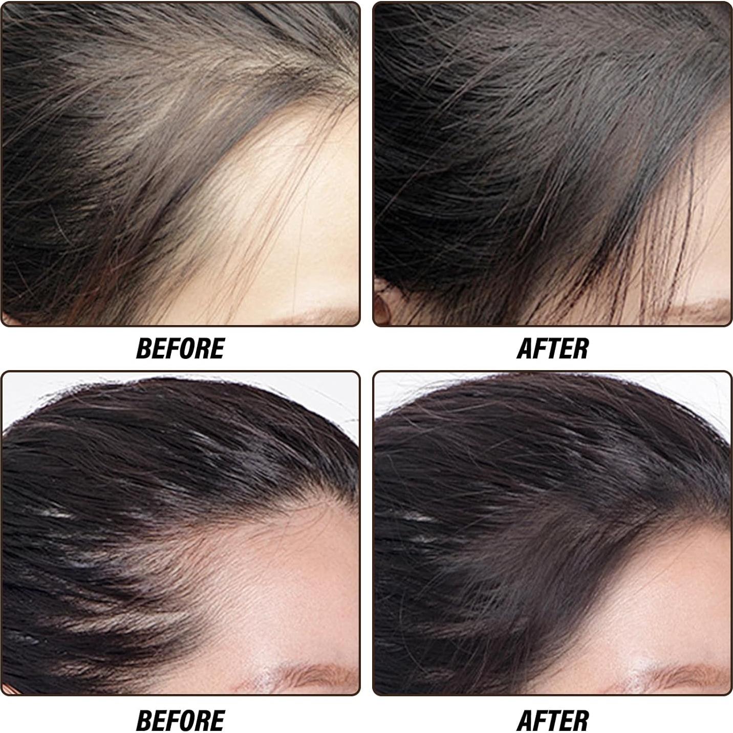 Polvo Rellenador para Raíces Shenzhenshimuyu 2.54 cm 3 en 1