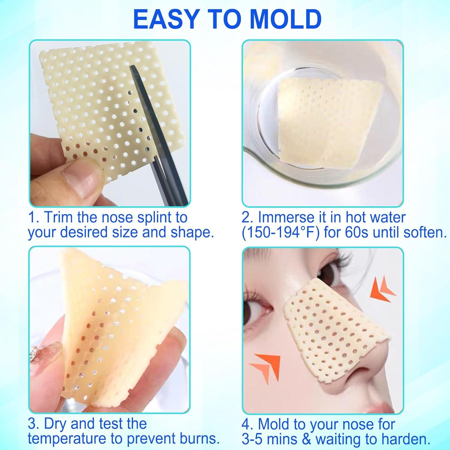 Juego de 6 Férulas Nasales Termoplásticas Anvosy para Rinoplastia