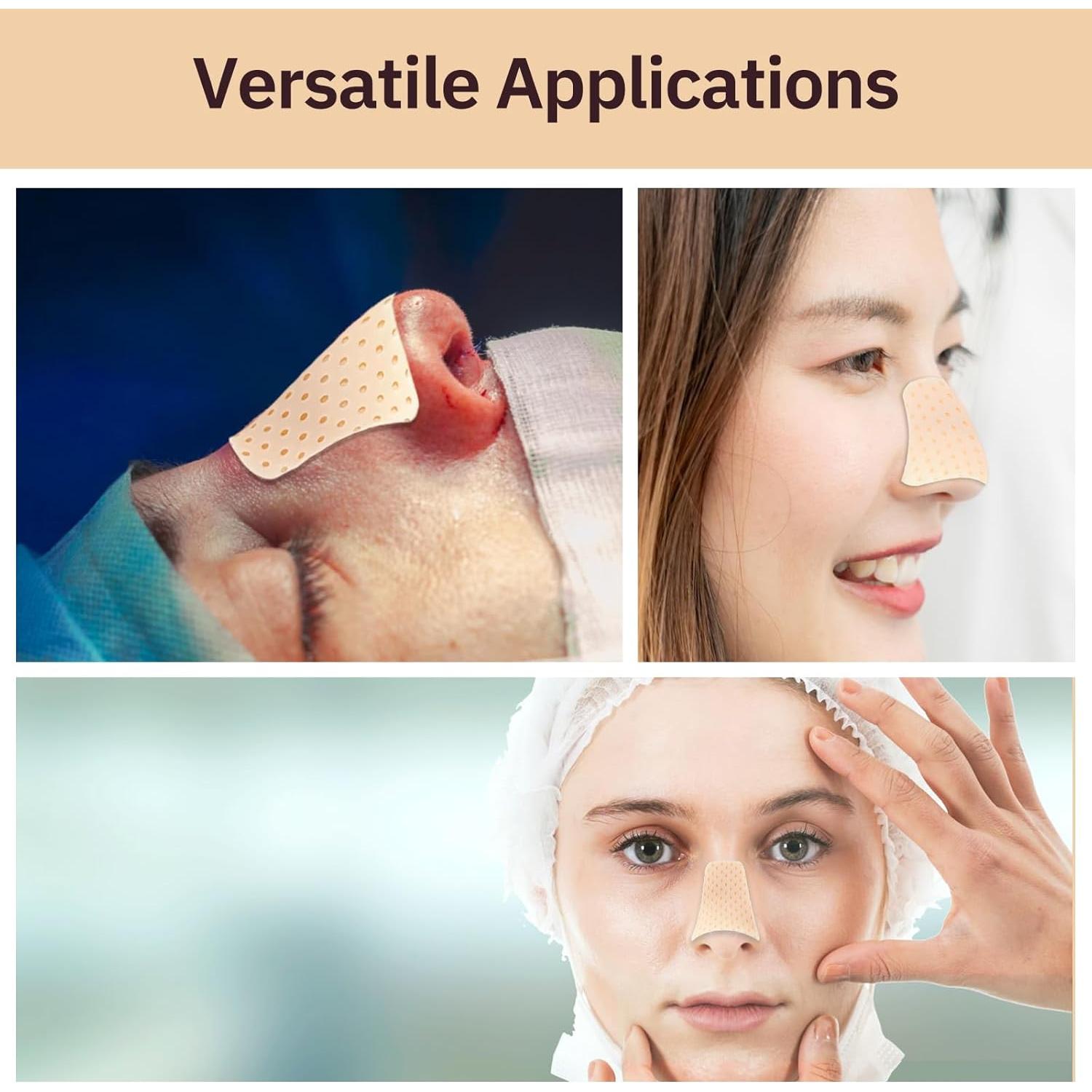 5 Férulas Nasales Termoplásticas Ziimaikery para Fracturas