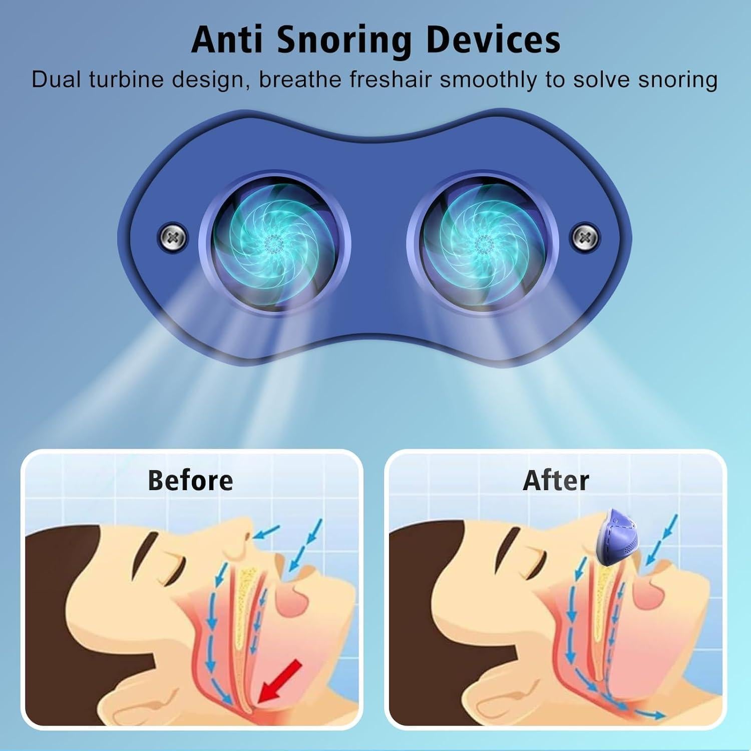 Dispositivo Anti Ronquidos Anitiate, Recargable, Azul