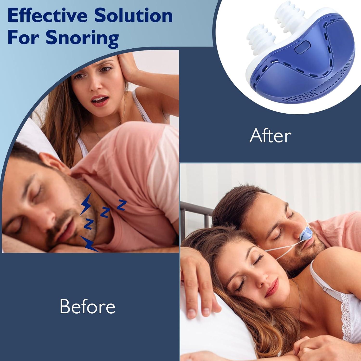 Dispositivo Anti Ronquidos NBF Azul, Ventilador Turbo Dual, Recargable