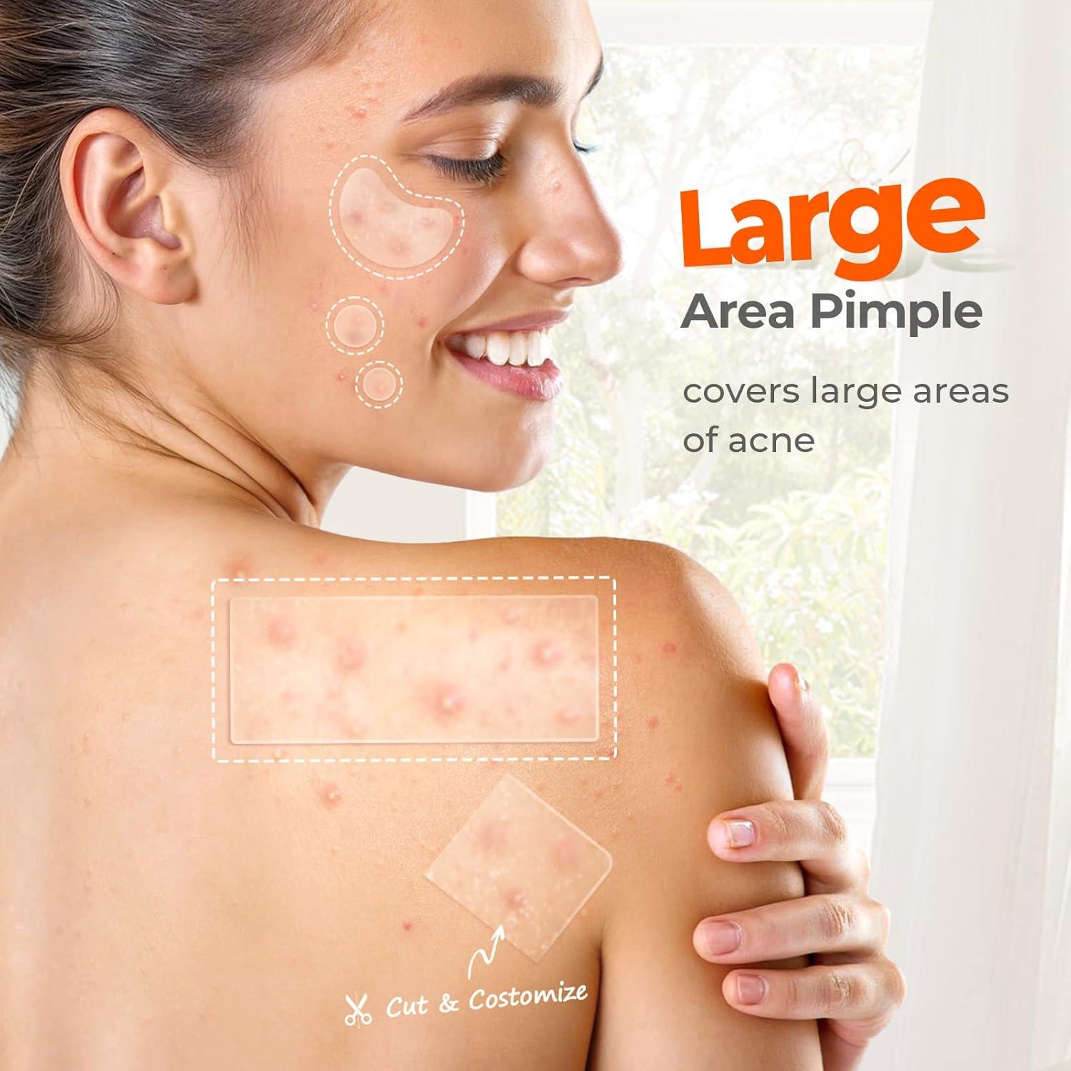 Parches para Acné TKTK XL 68x27mm - 24 Piezas Hidrocoloides