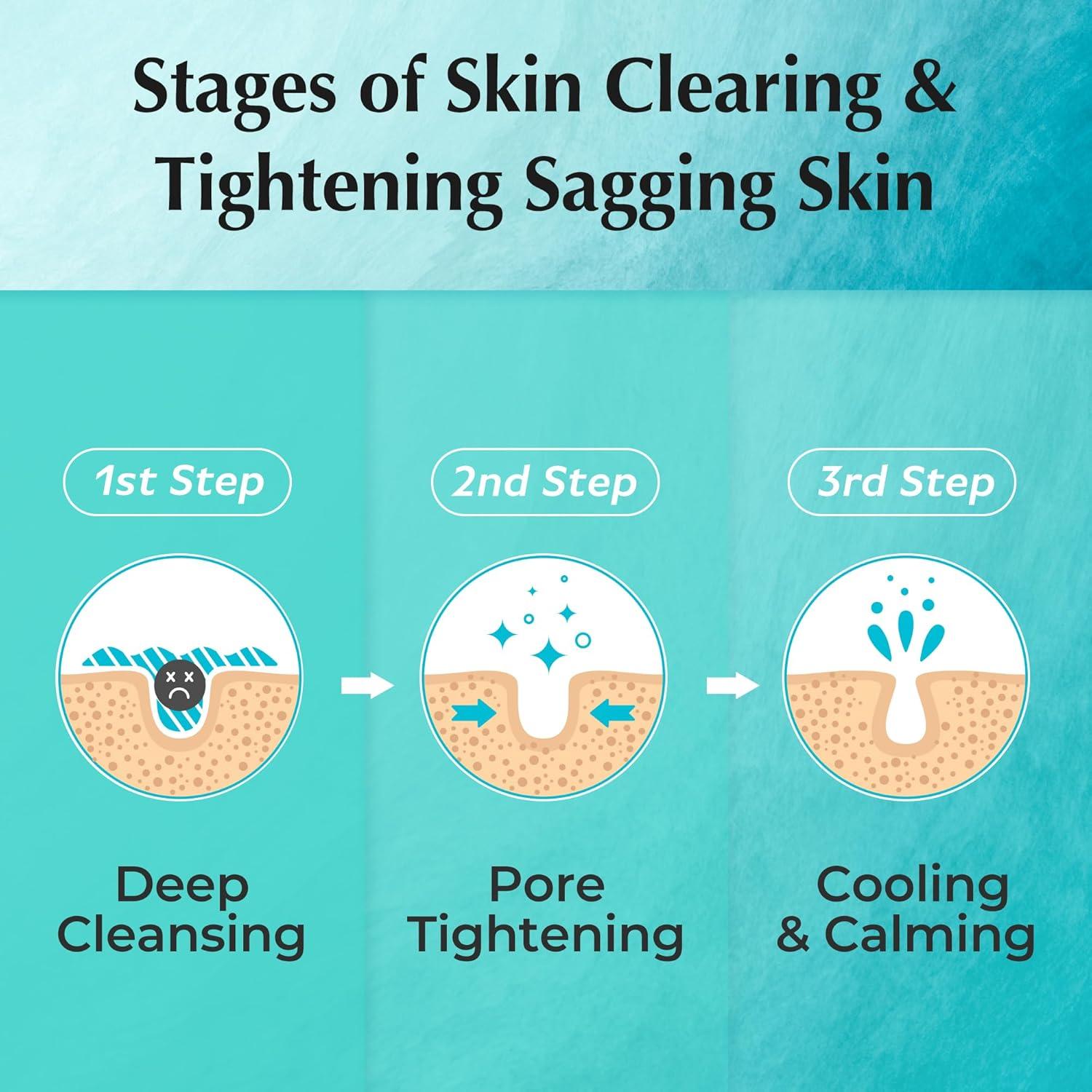 Mascarilla de Arcilla Be Frozen Pores 120 g - Limpieza Profunda