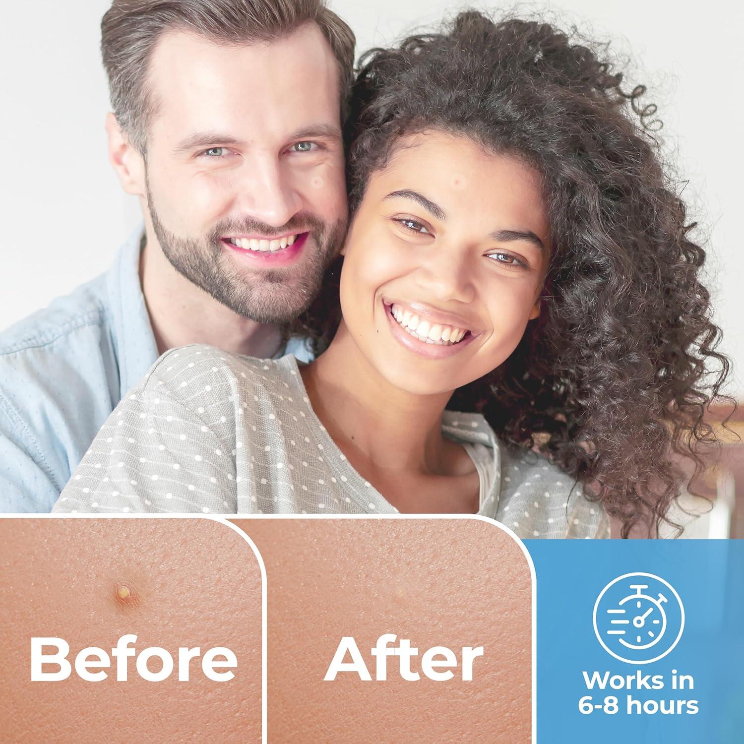 Parche Hidrocoloide para Granitos BASIC CONCEPTS - 120 Piezas