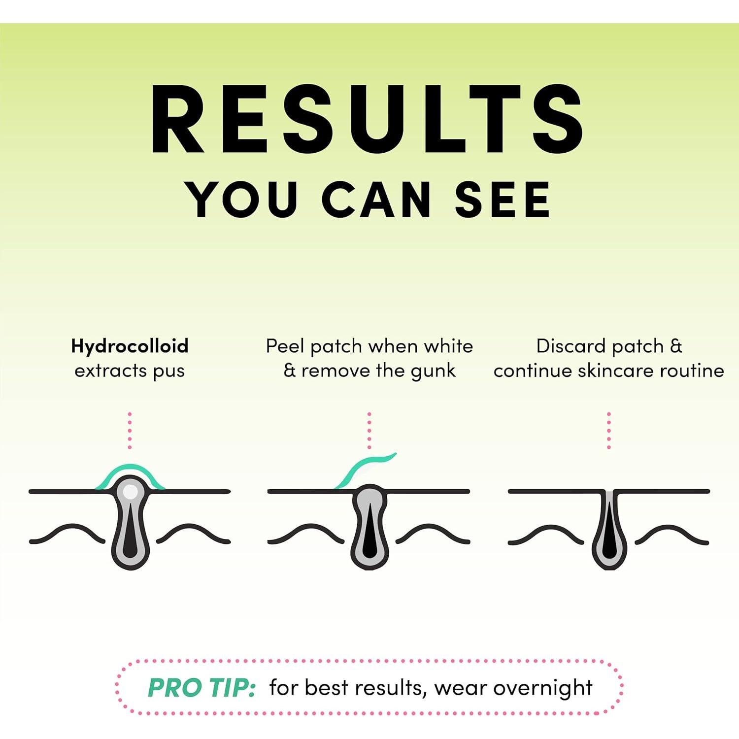 Parche para Granos Dots for Spots - Hidrocoloide 60 Unidades