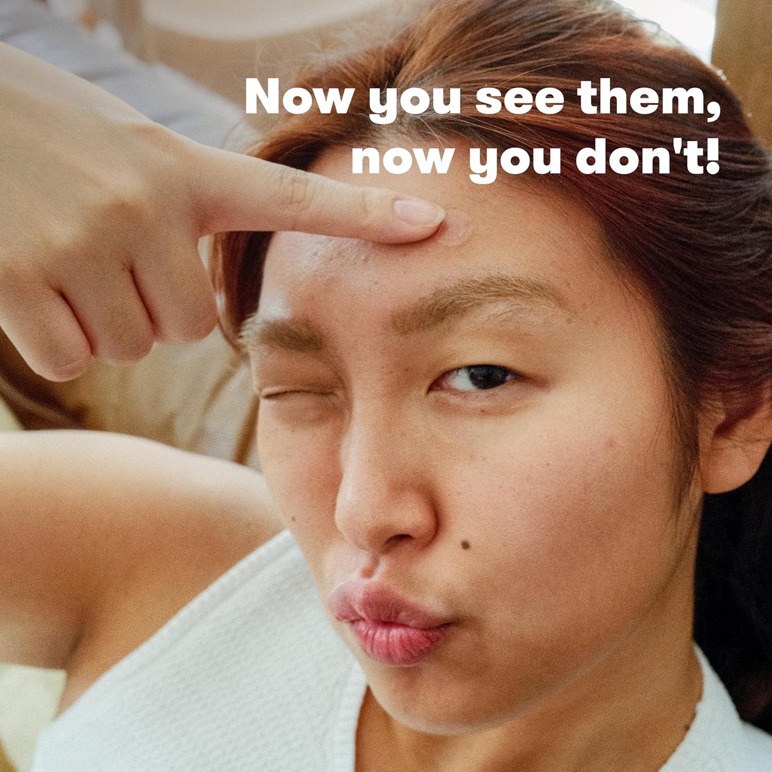 Parches para Acné Proactiv Zits Happen - 30 Unidades