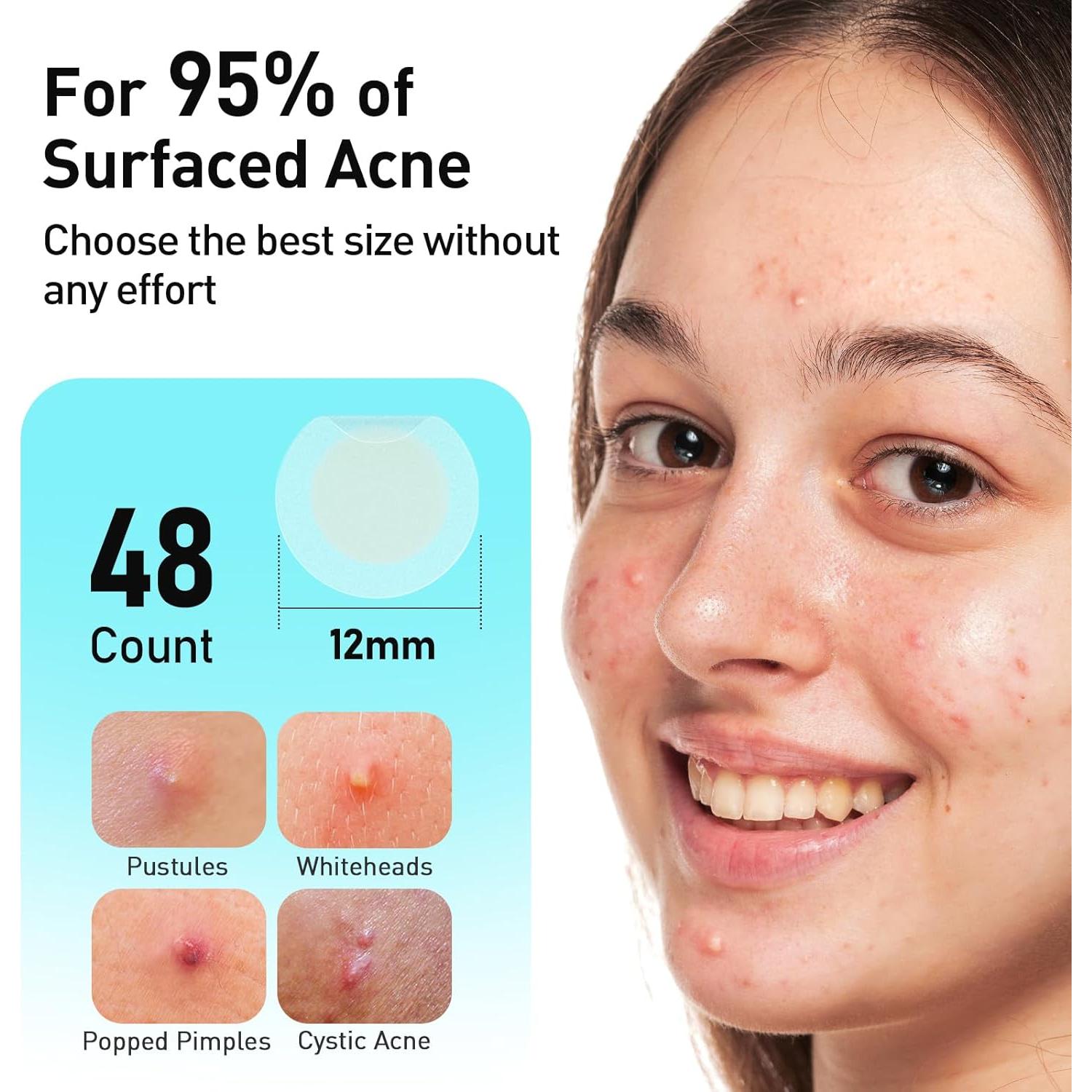 Parche para Acné TKTK 12mm Hidrocoloide 48 Unidades