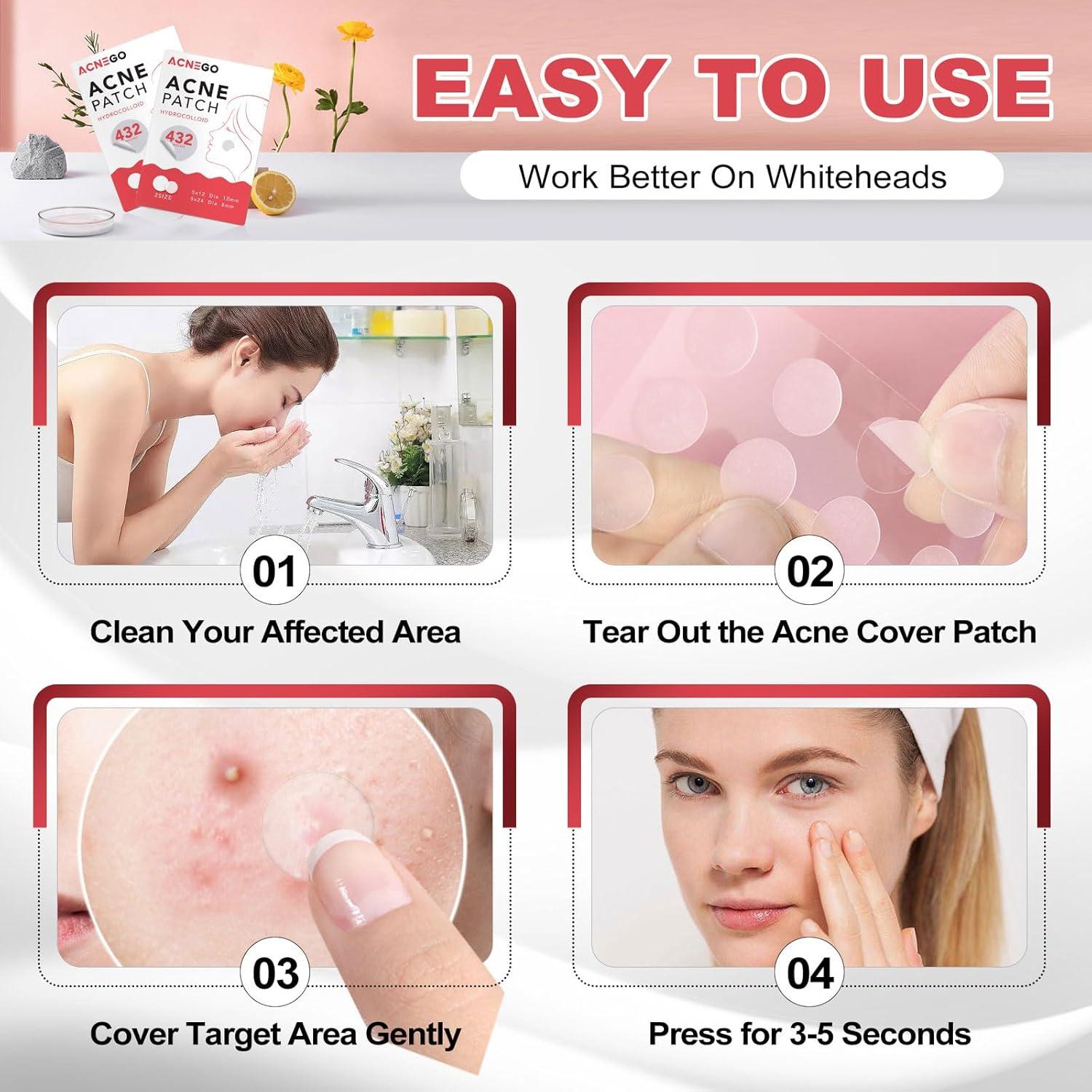 Parches para Acné Hidrocoloides AcneGo 432 Contadores 8mm y 12mm