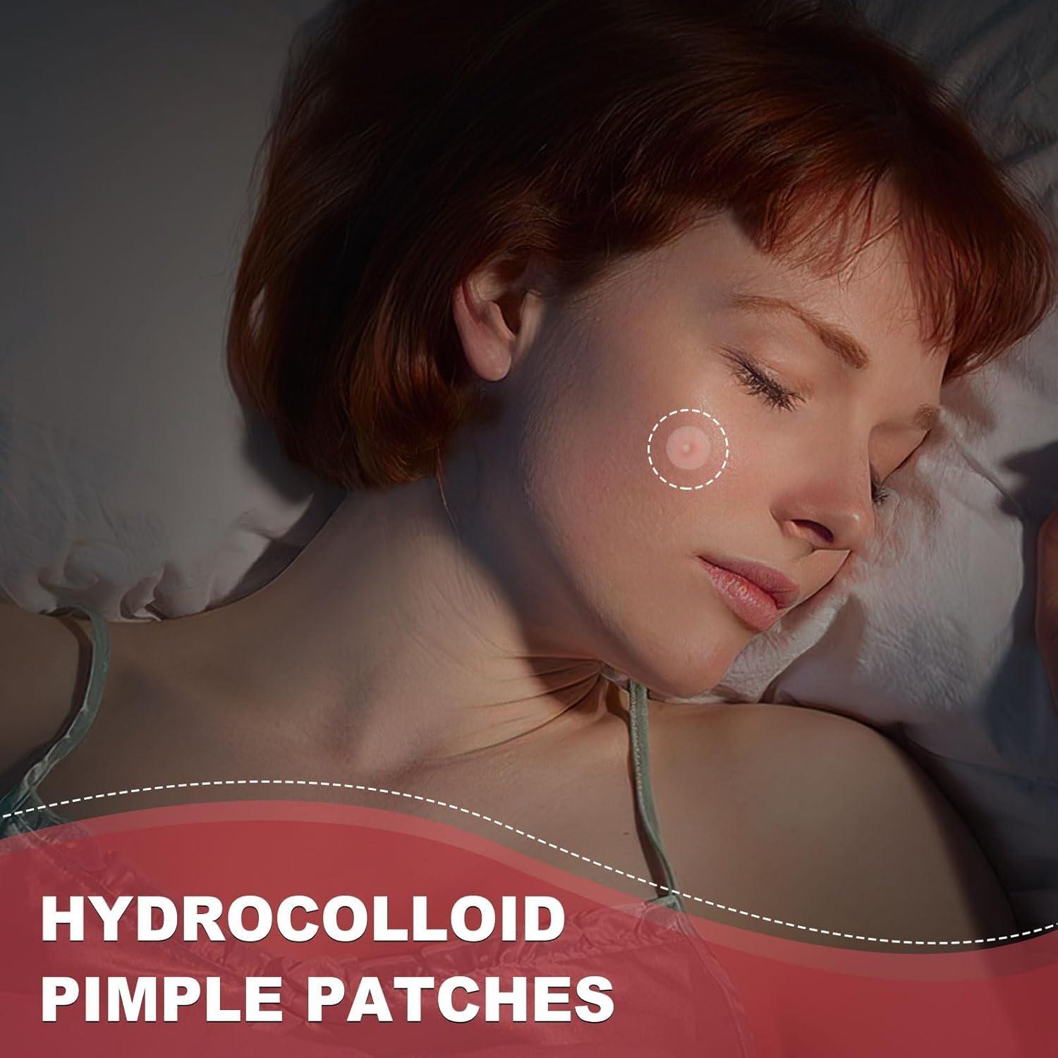 Parches para Acné Hidrocoloides AcneGo 432 Contadores 8mm y 12mm