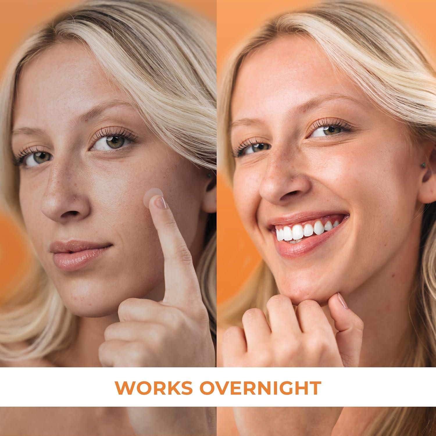 Parche para Granos Hidrocoloide PatchRx - 240 Unidades