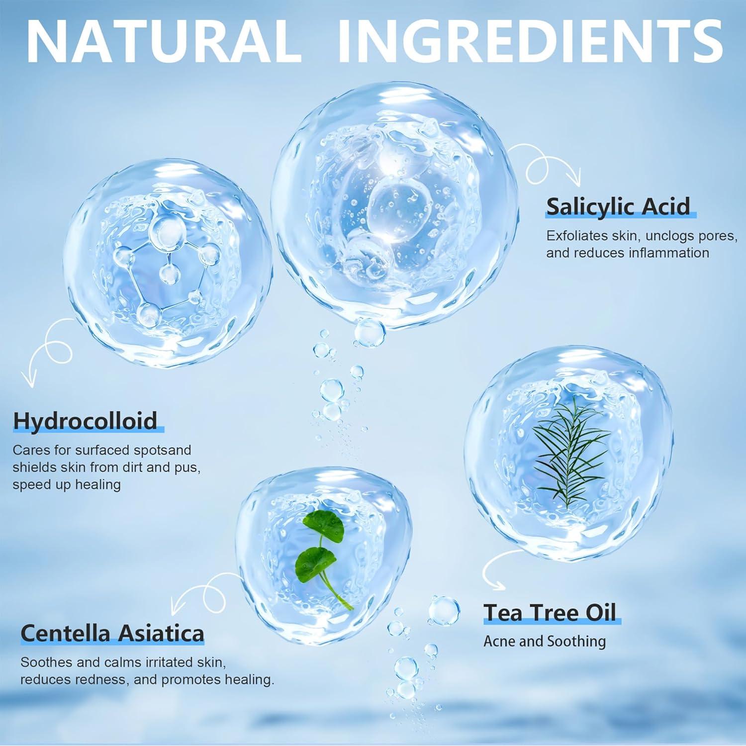 Parches para Acné Hidrocoloides Jo Dominic - 360 Piezas