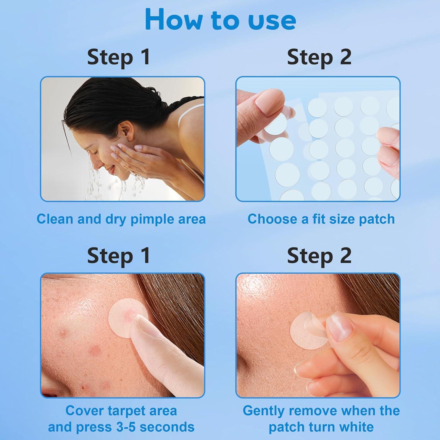 Parches para Acné Hidrocoloides Jo Dominic - 360 Piezas