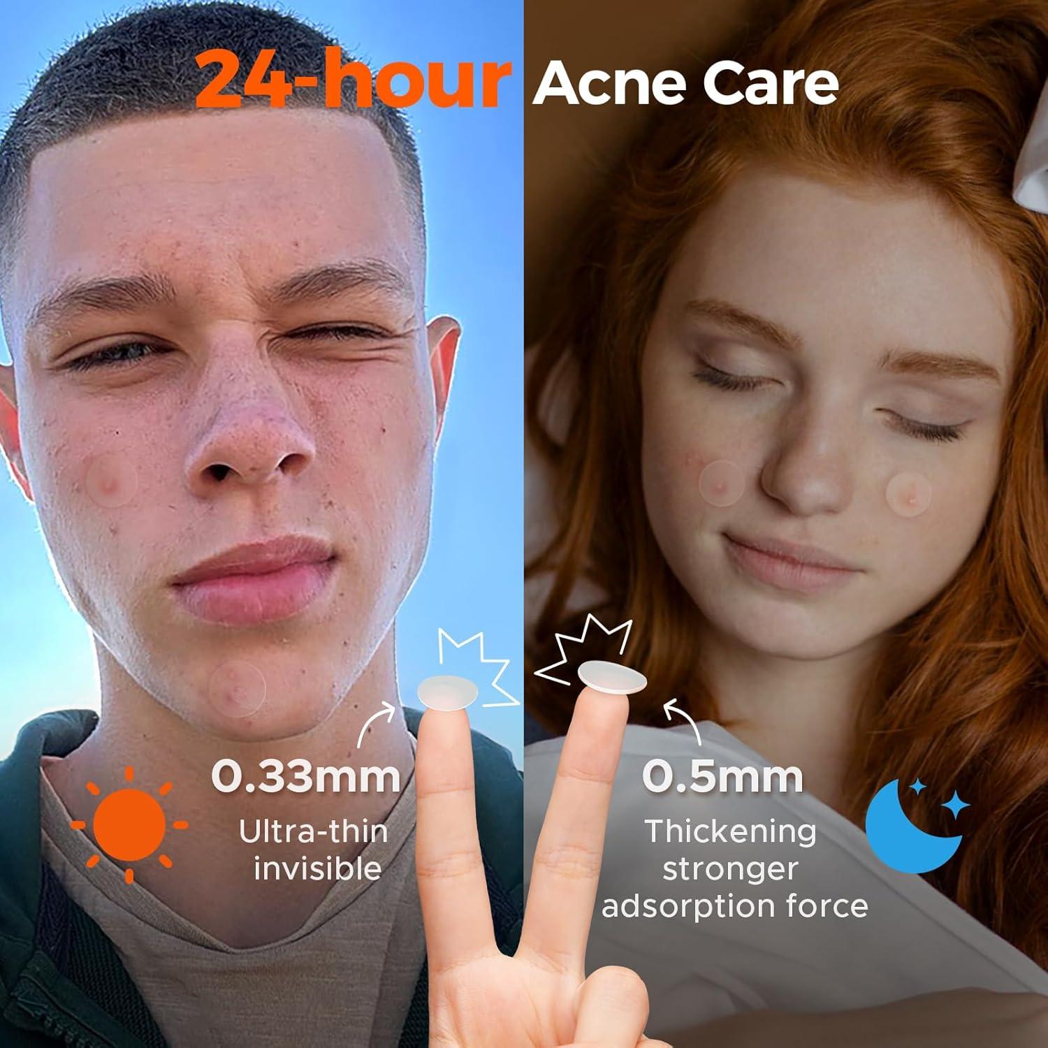 Parches para Acné TKTK - 435 Unidades, Hidrocoloides Día y Noche