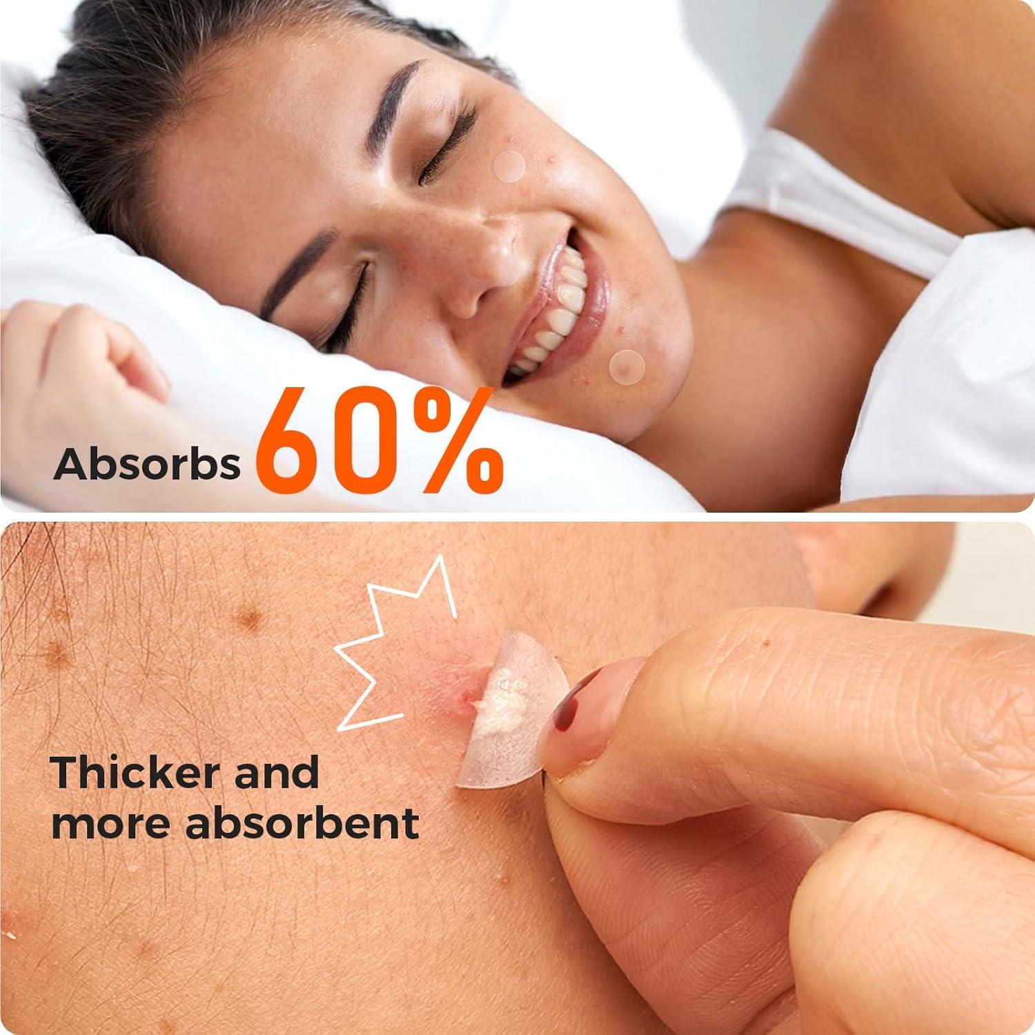 Parches para Acné TKTK - 435 Unidades, Hidrocoloides Día y Noche