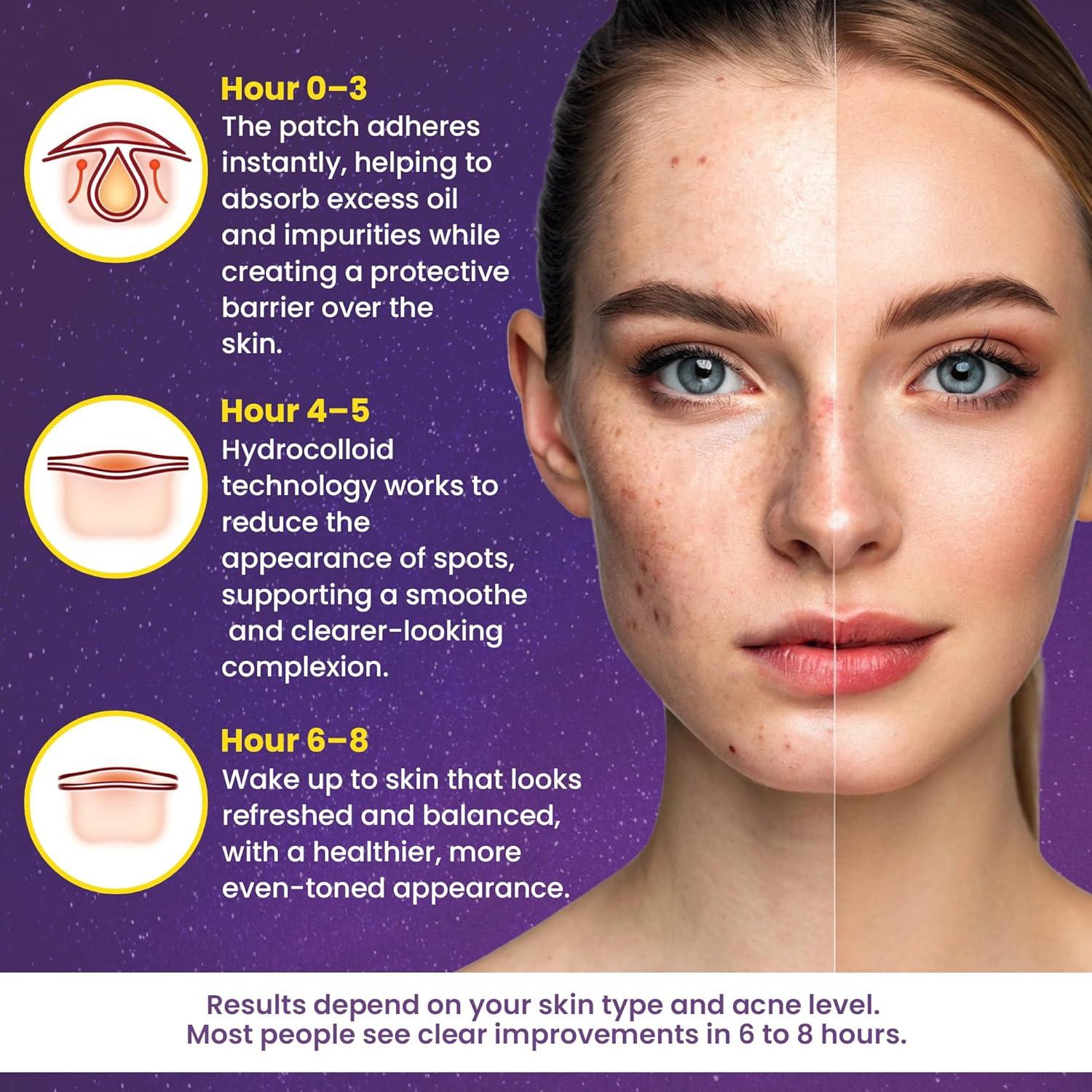 280 Parches Hidrocoloides Estrella Andlane - 3 Tamaños Multicolor