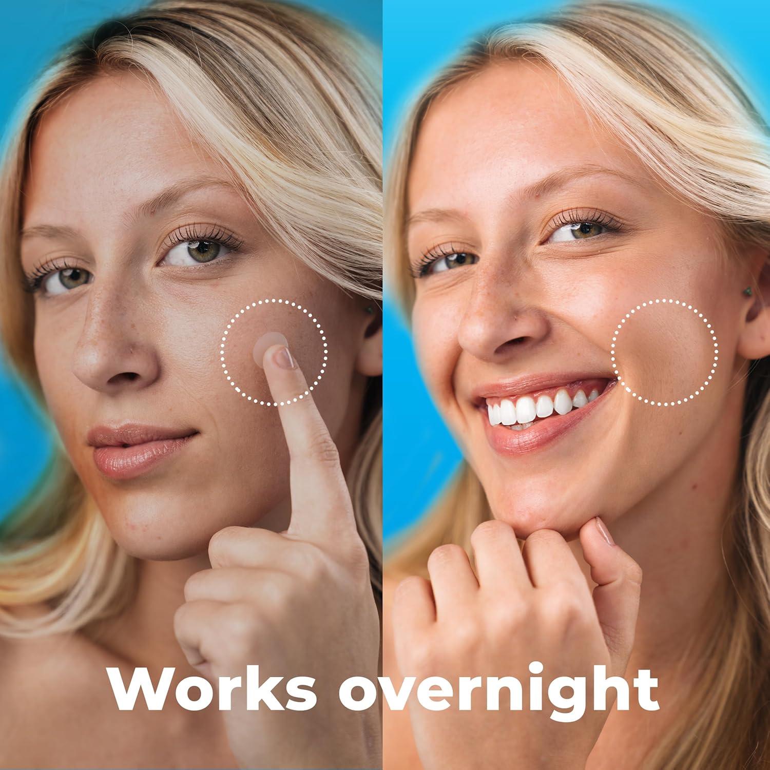 Parches para Granos Hydrocolloid PatchRx - 240 Unidades con Aceite de Árbol de Té