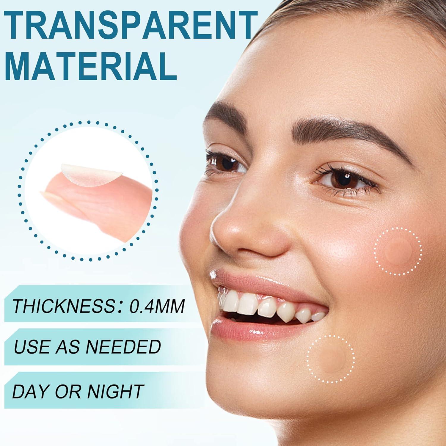 Parches para Acné LotFancy - 240 Unidades, 3 Tamaños (8, 10, 12mm)