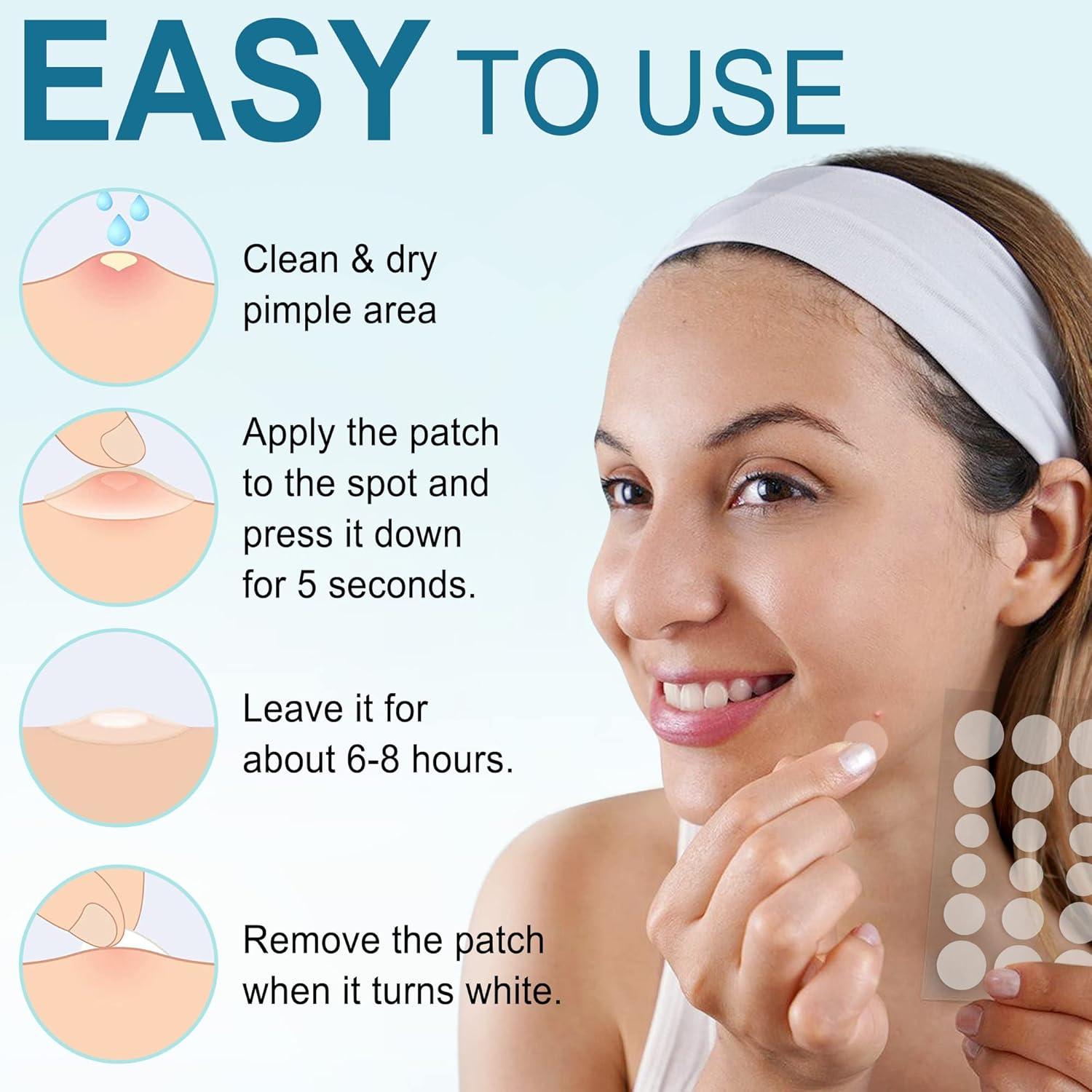 Parches para Acné LotFancy - 240 Unidades, 3 Tamaños (8, 10, 12mm)