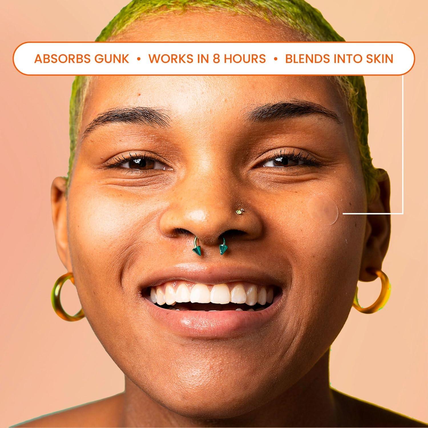 Parches para Granitos Biore 30 Unidades Hidrocoloide Grado Médico