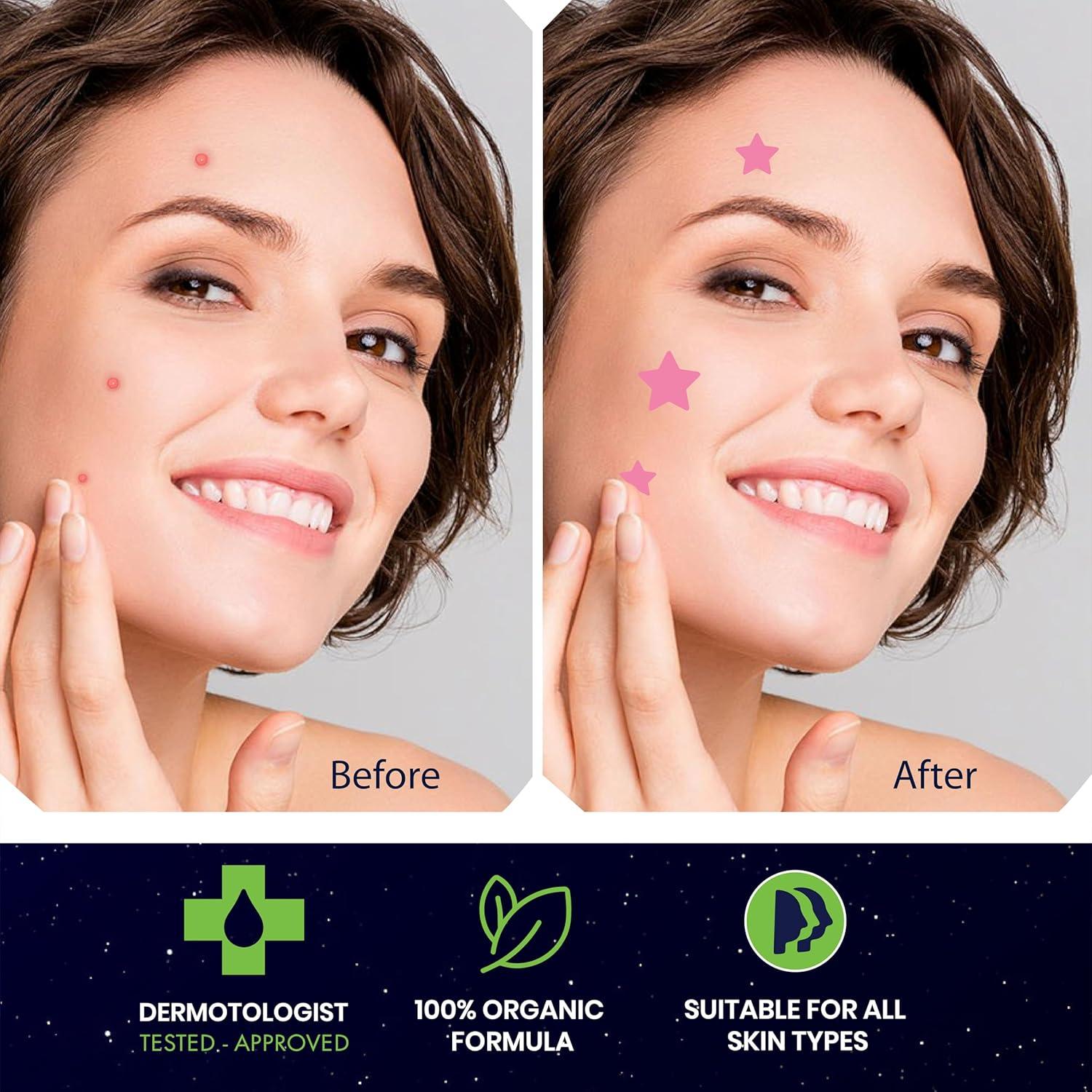 Parche para Granos Estrella Star - Hidrocoloide 40 Unidades