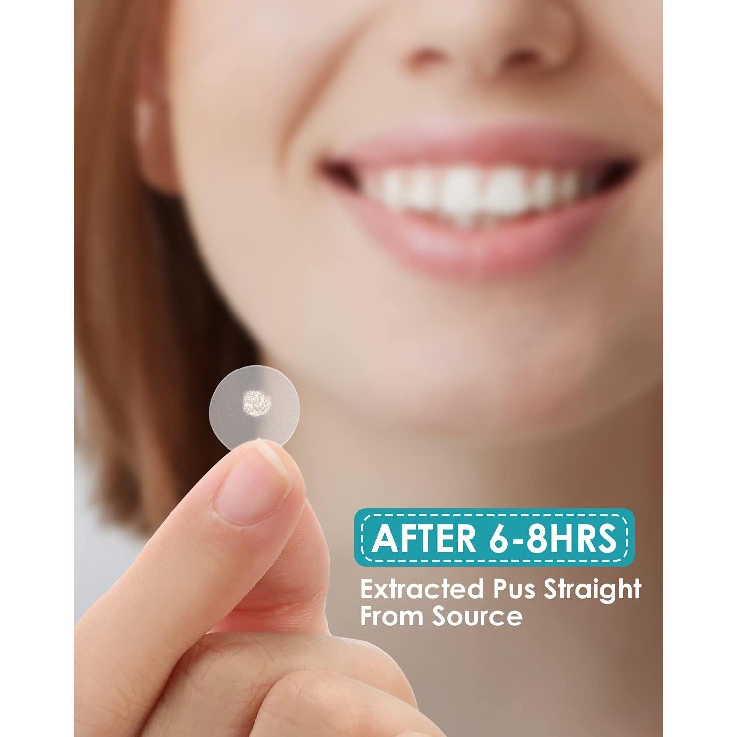 Parche para Granos de Acné HeroLabs - Hidrocoloide Vegano 144 Unidades