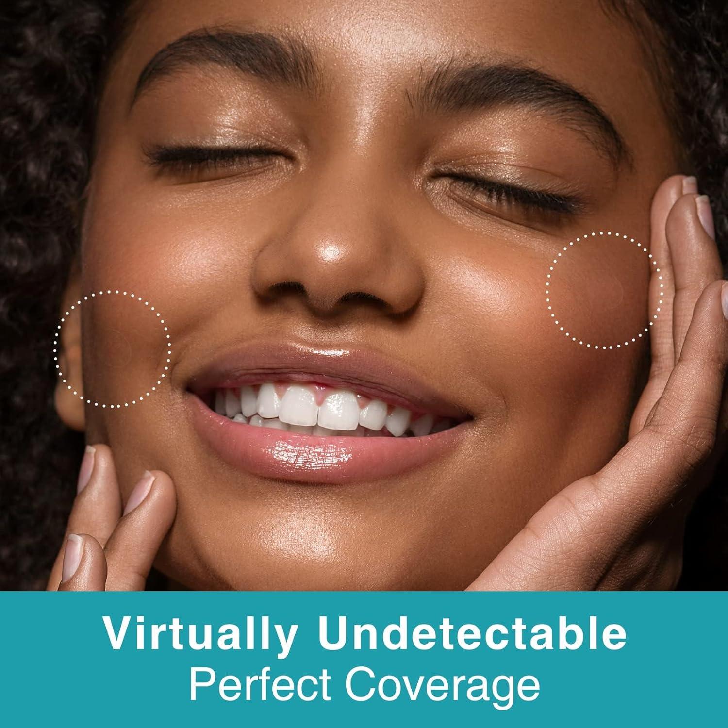 Parche para Granos de Acné HeroLabs - Hidrocoloide Vegano 144 Unidades